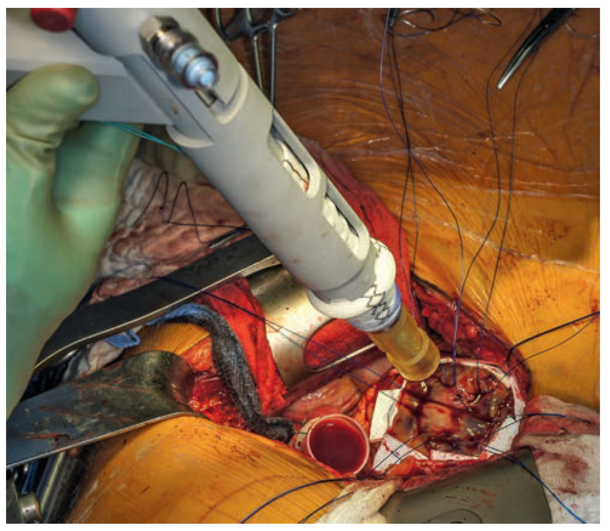 Cardiovascmed 17 00143 g003