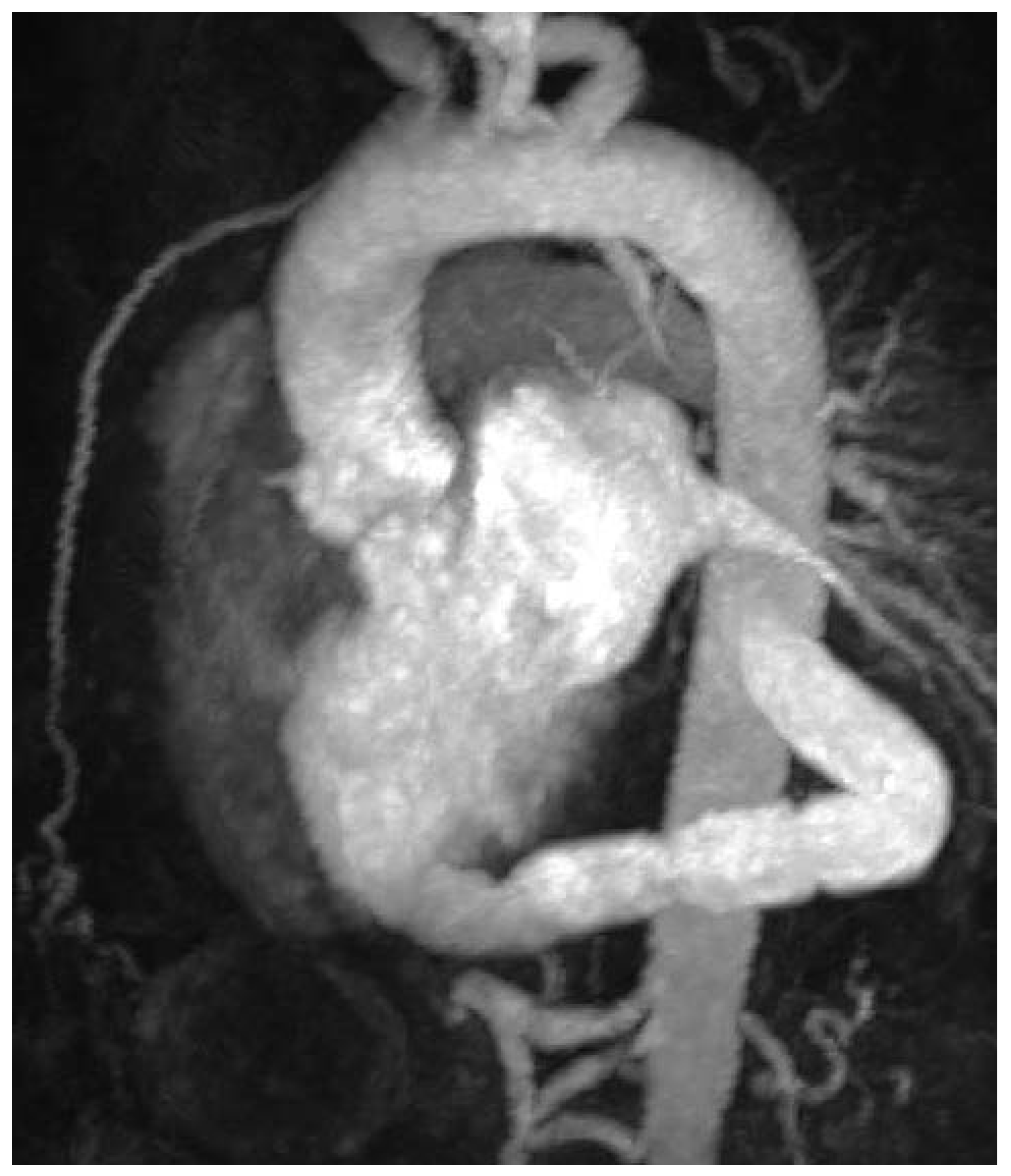 Cardiovascmed 17 00143 g004