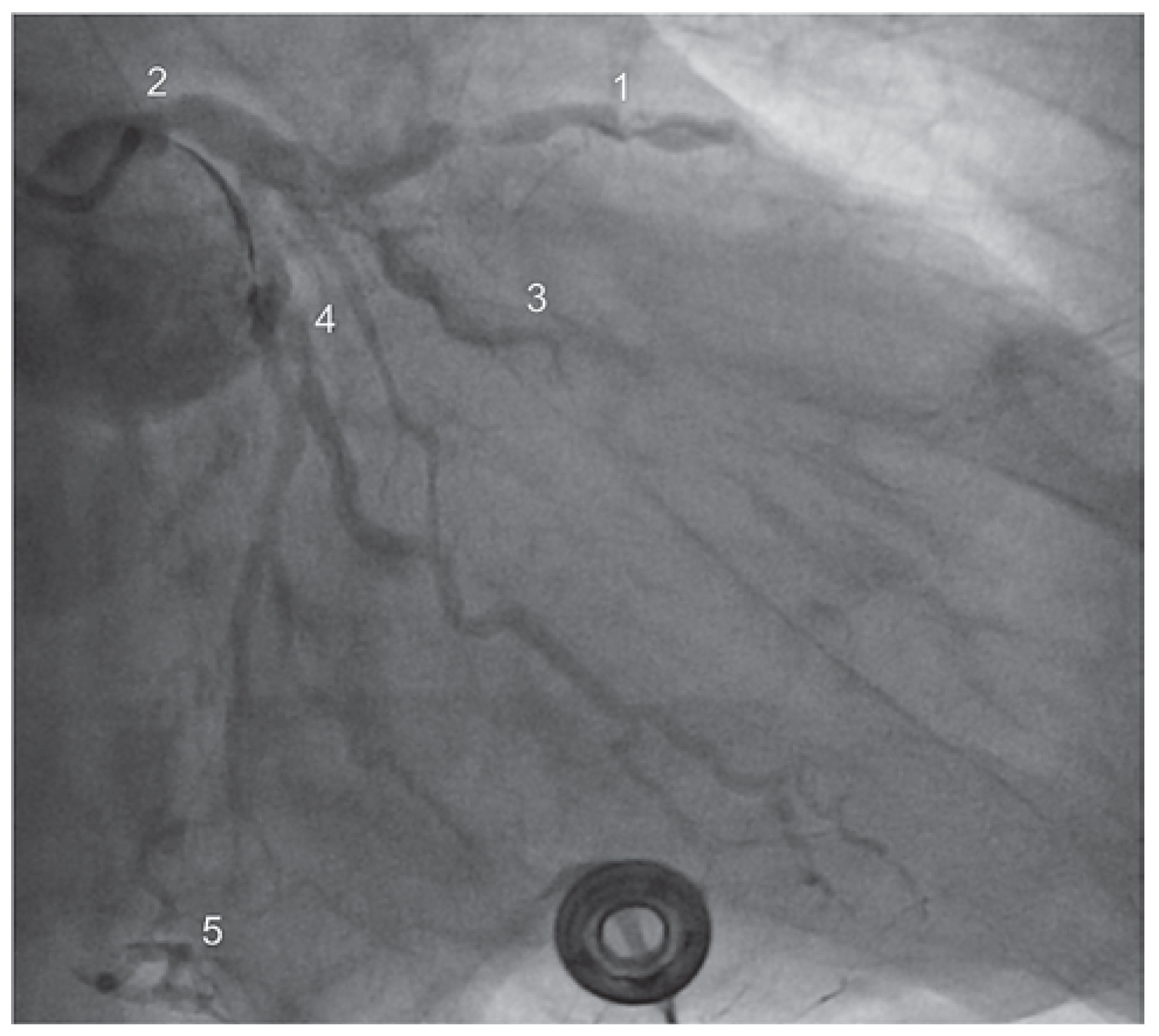Cardiovascmed 17 00146 g001