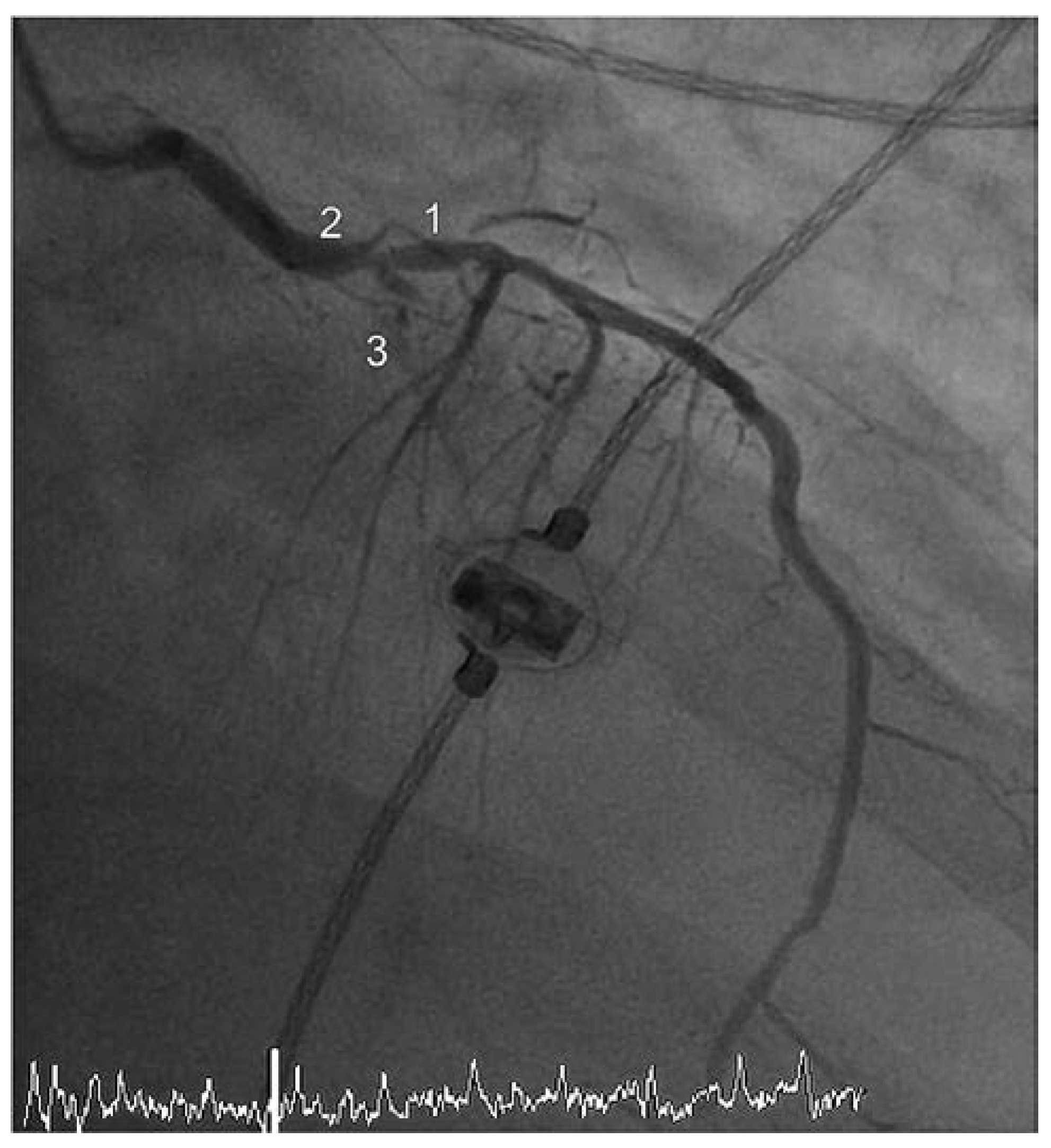 Cardiovascmed 17 00146 g003