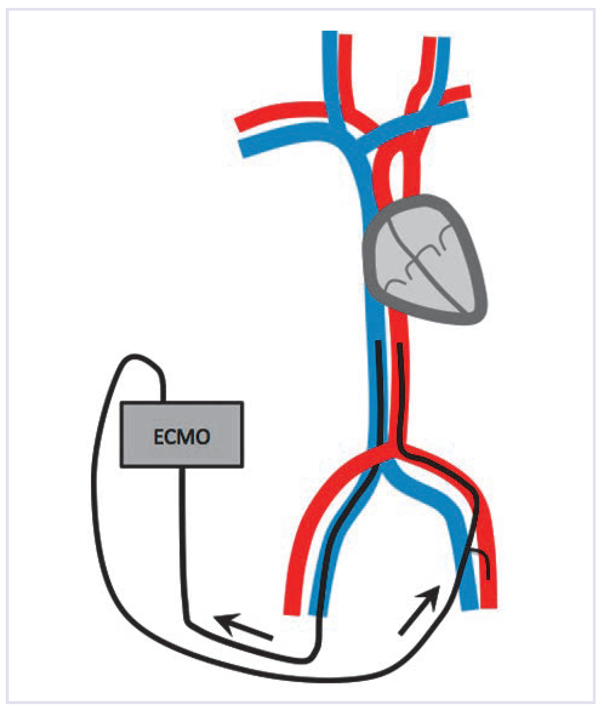 Cardiovascmed 17 00146 g005