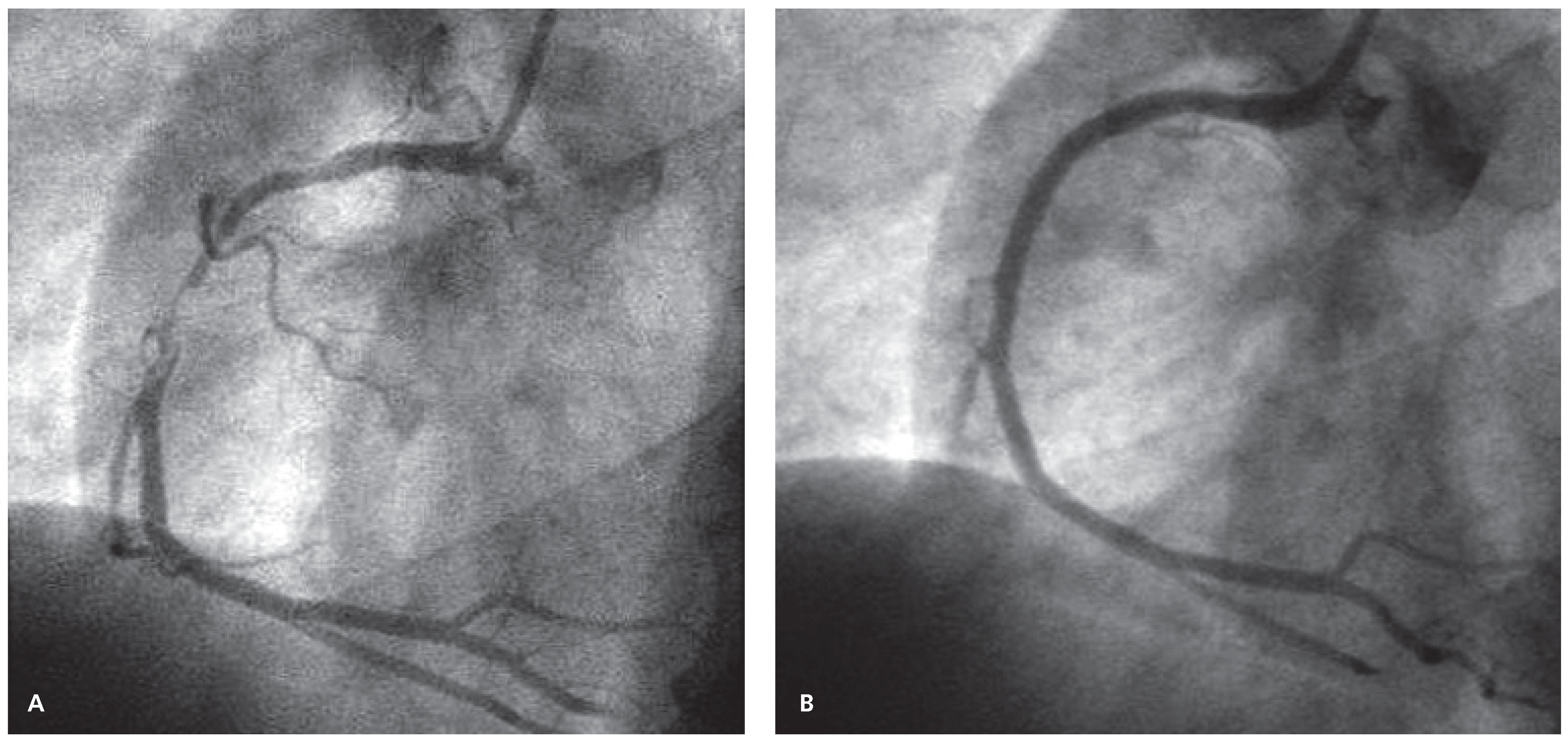 Cardiovascmed 17 00151 g001 Cardiovascmed 17 00151 g001