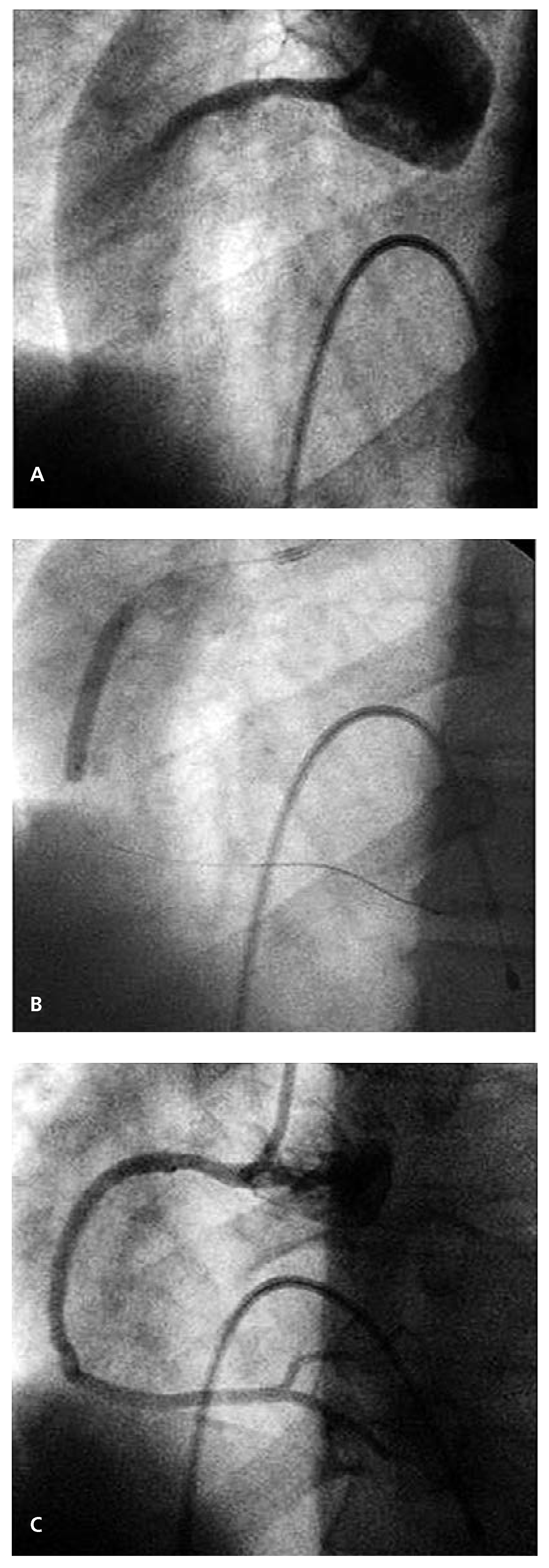 Cardiovascmed 17 00151 g002 Cardiovascmed 17 00151 g002