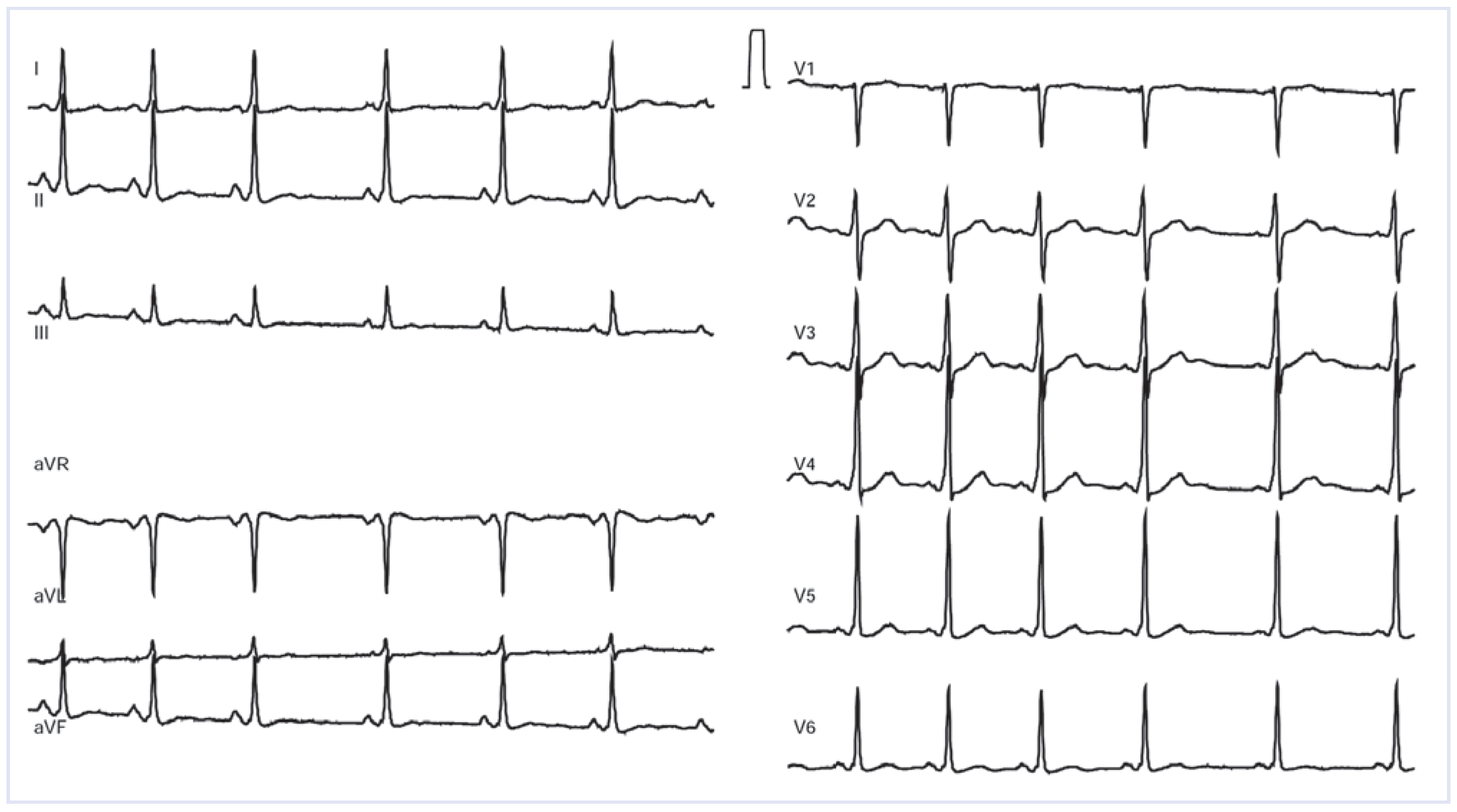 Cardiovascmed 17 00153 g001