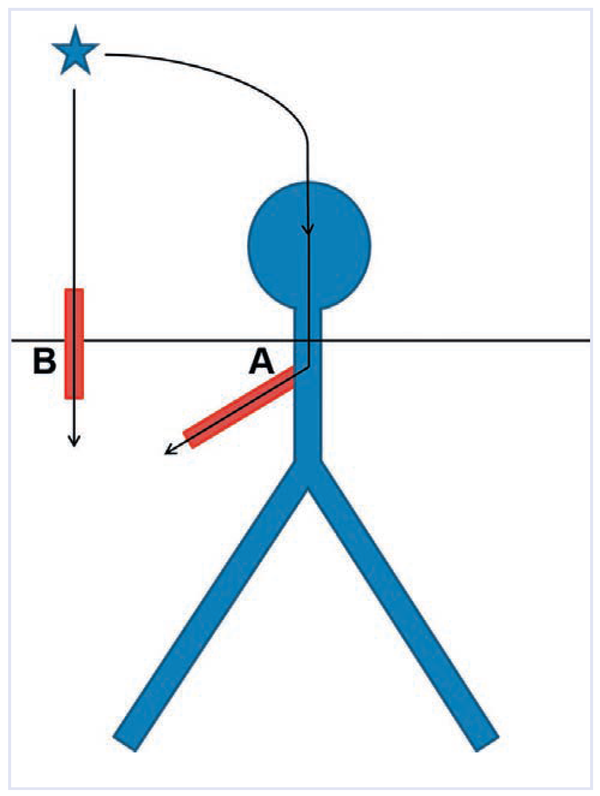 Cardiovascmed 17 00153 g003