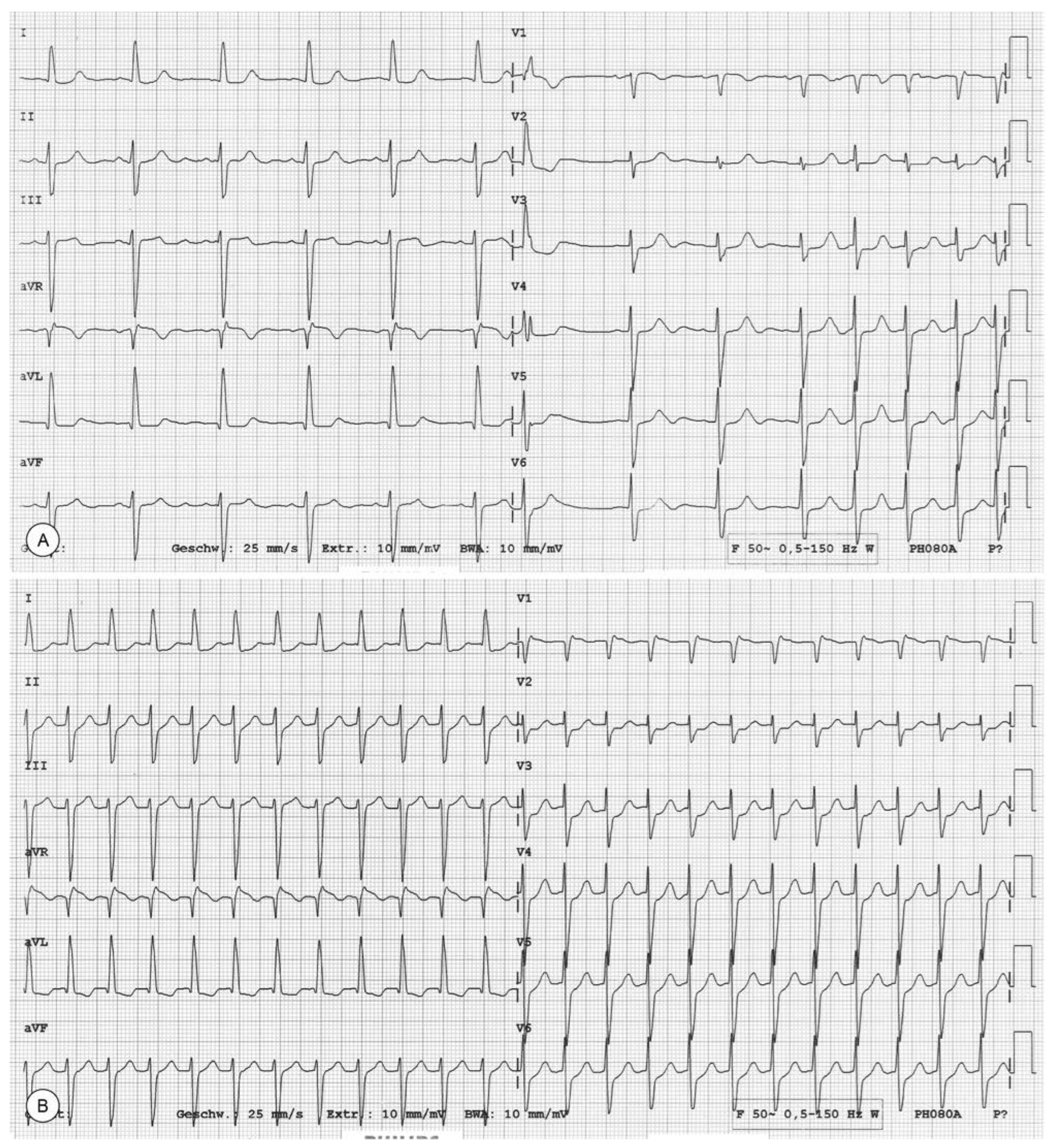 Cardiovascmed 17 00156 g001 Cardiovascmed 17 00156 g001