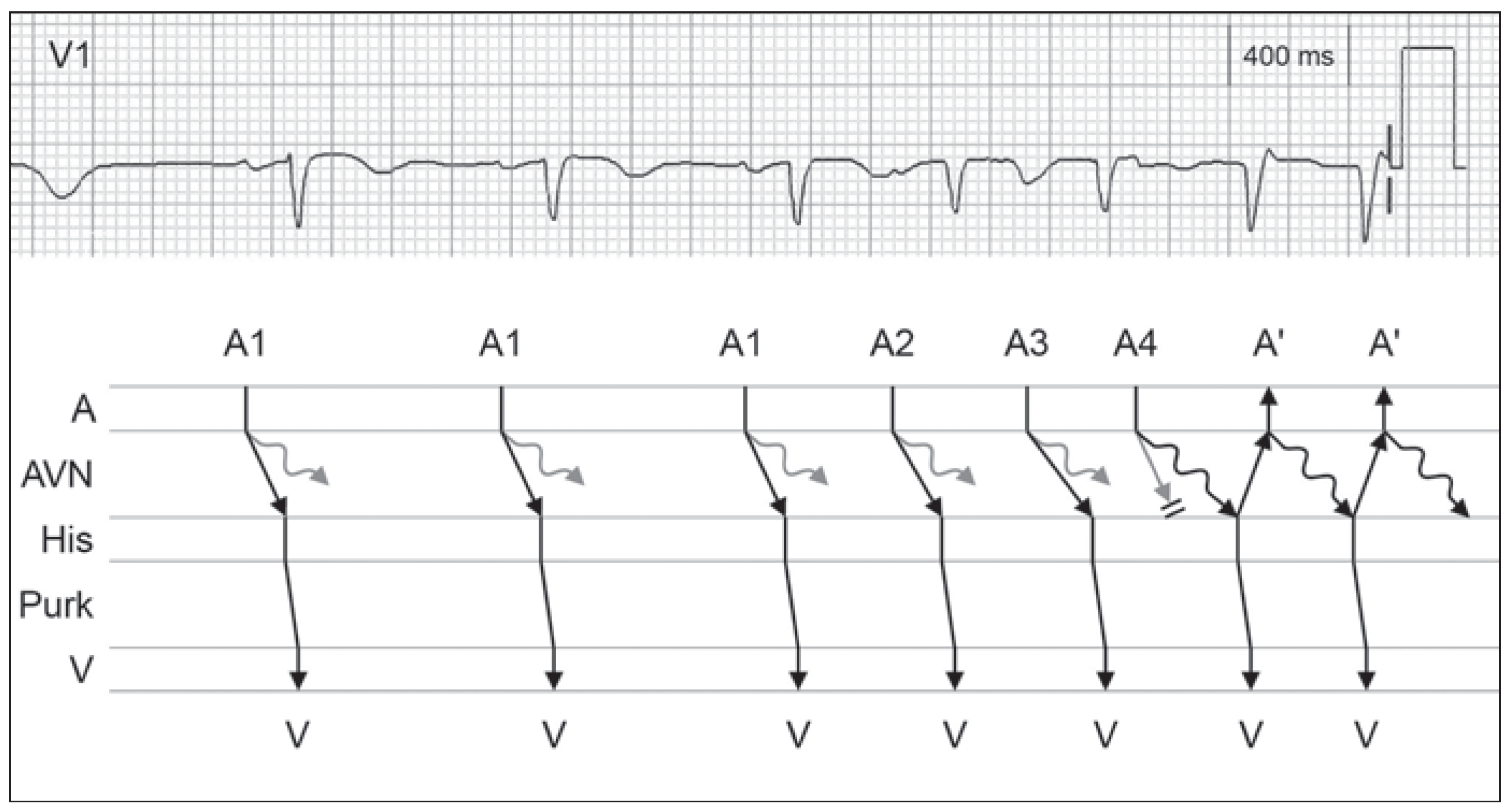 Cardiovascmed 17 00156 g002 Cardiovascmed 17 00156 g002