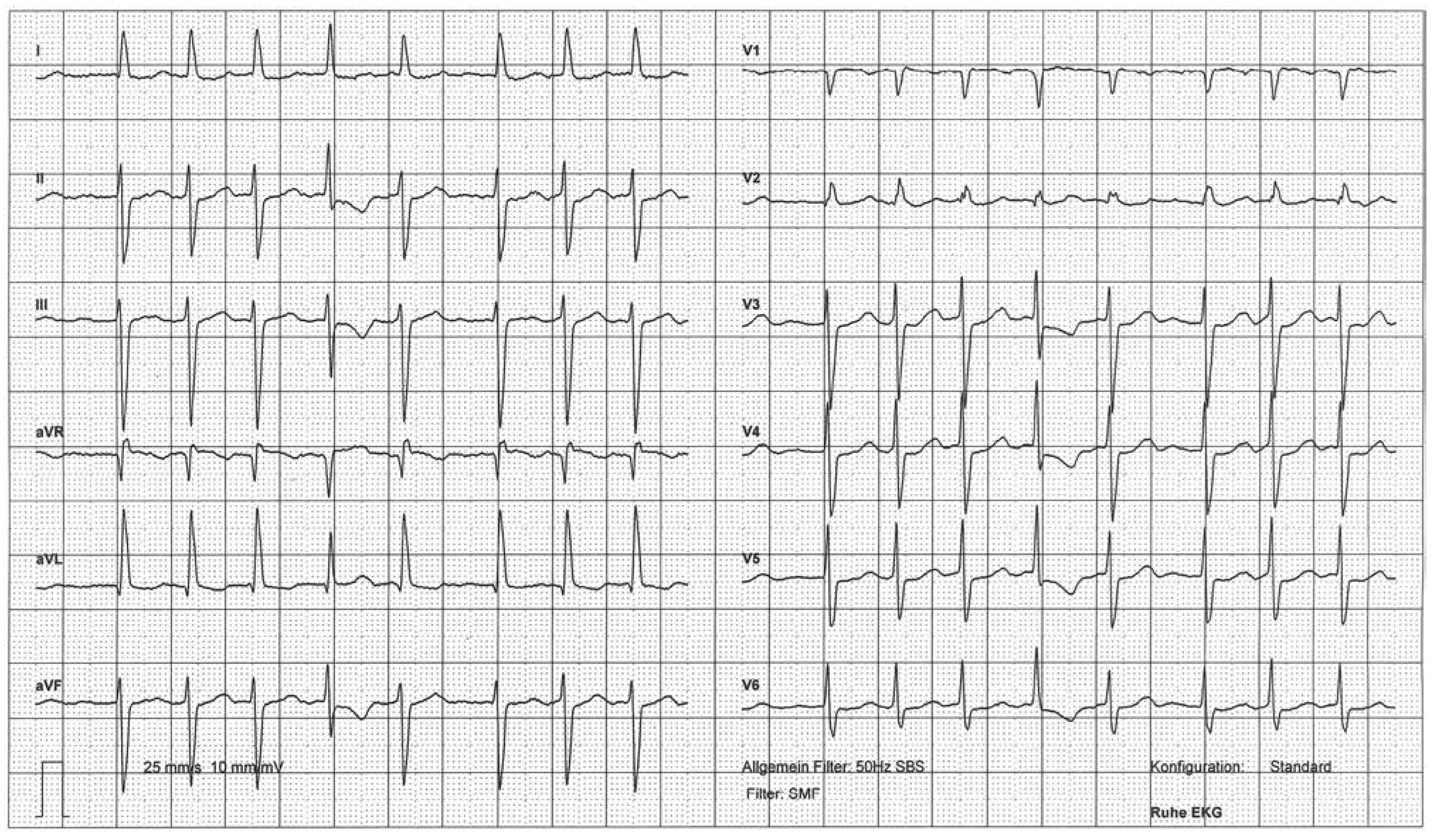 Cardiovascmed 17 00156 g003 Cardiovascmed 17 00156 g003