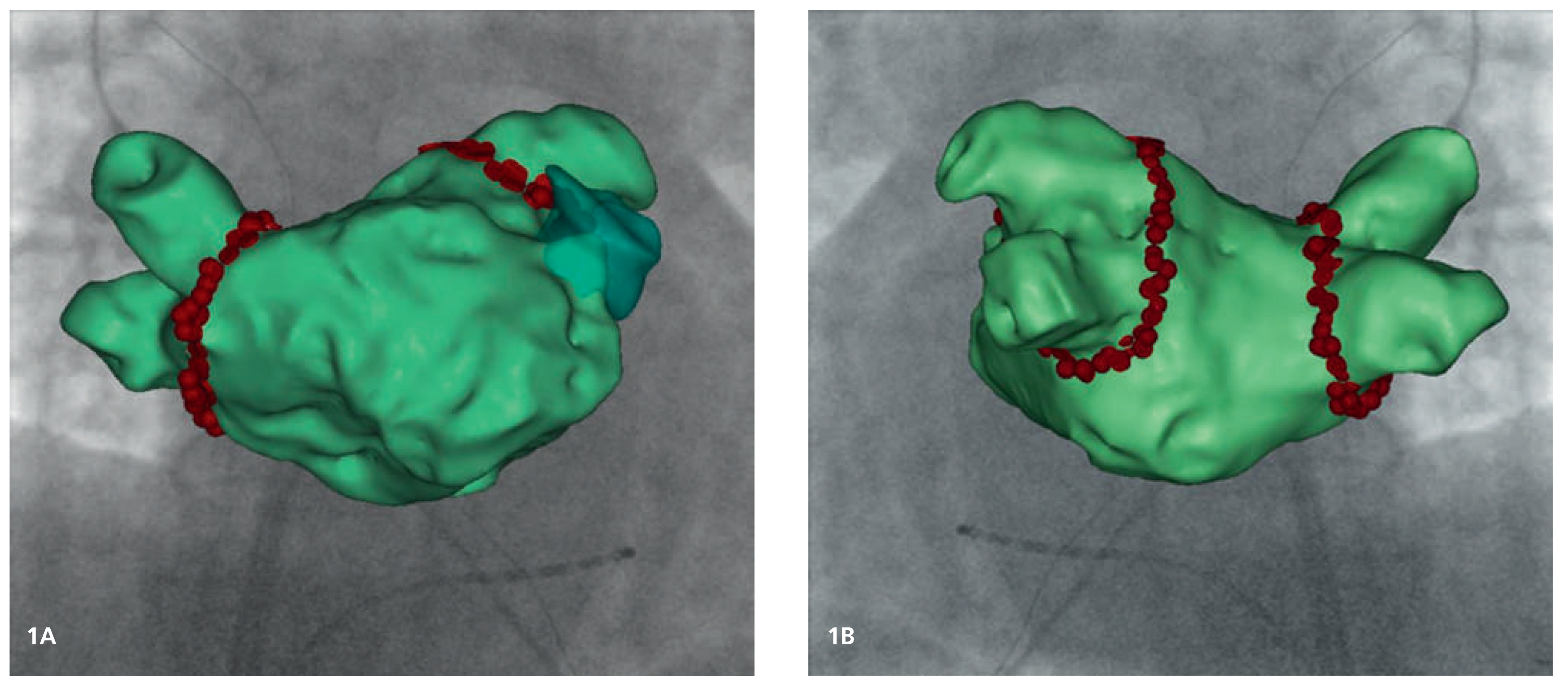 Cardiovascmed 17 00171 g001 Cardiovascmed 17 00171 g001