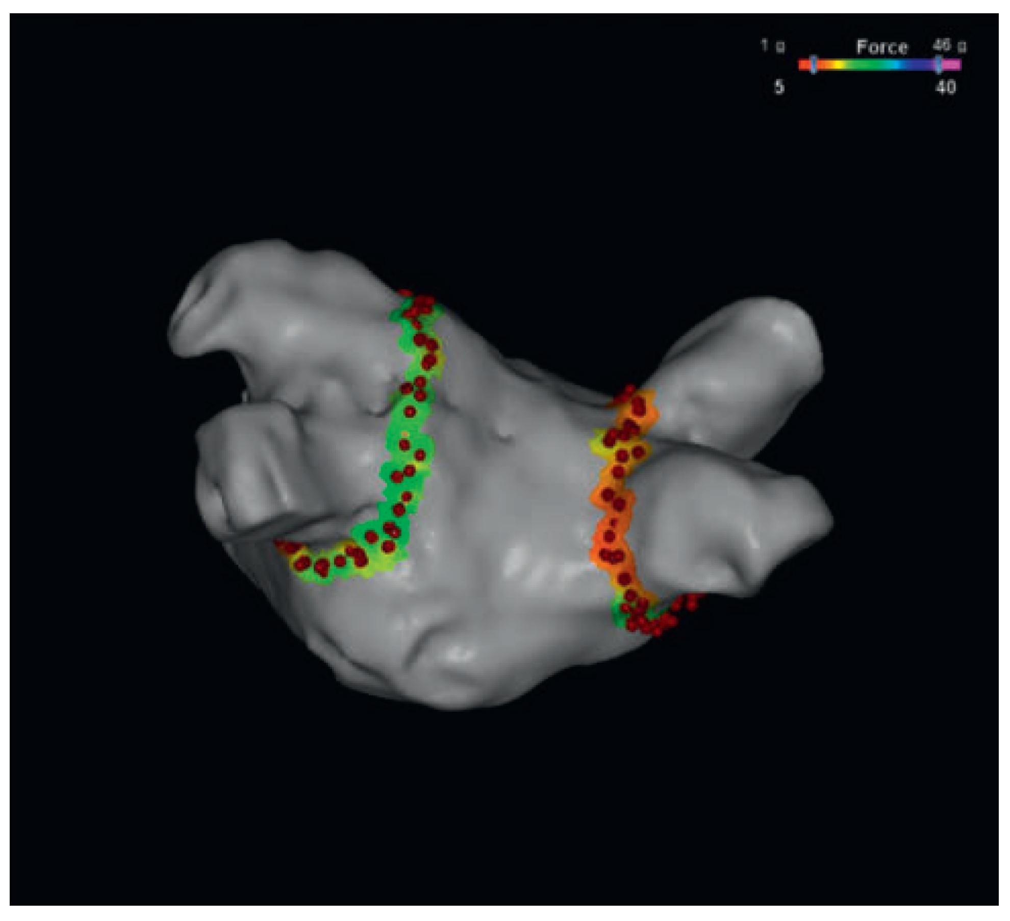 Cardiovascmed 17 00171 g005 Cardiovascmed 17 00171 g005