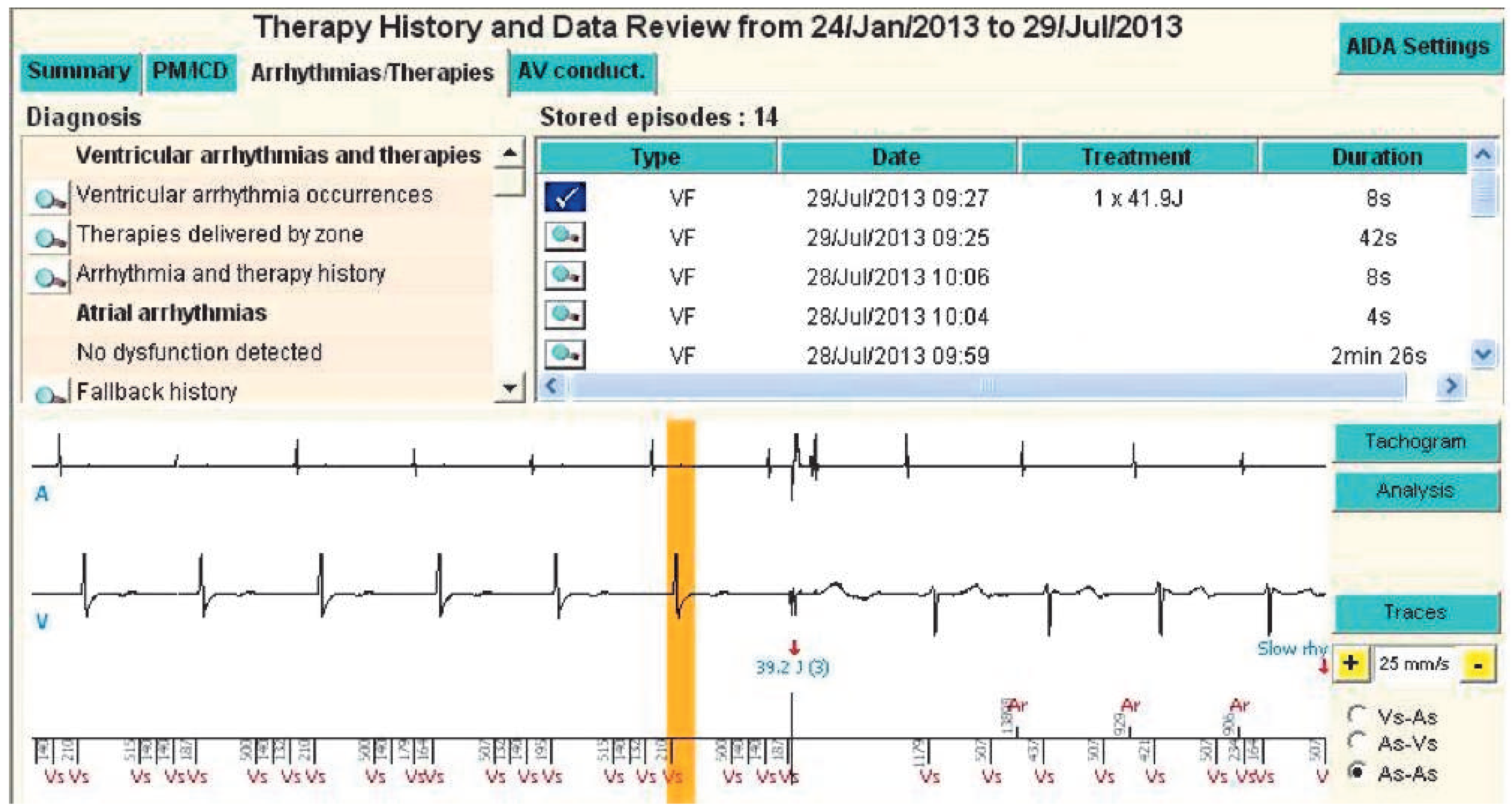 Cardiovascmed 17 00186 g001 Cardiovascmed 17 00186 g001