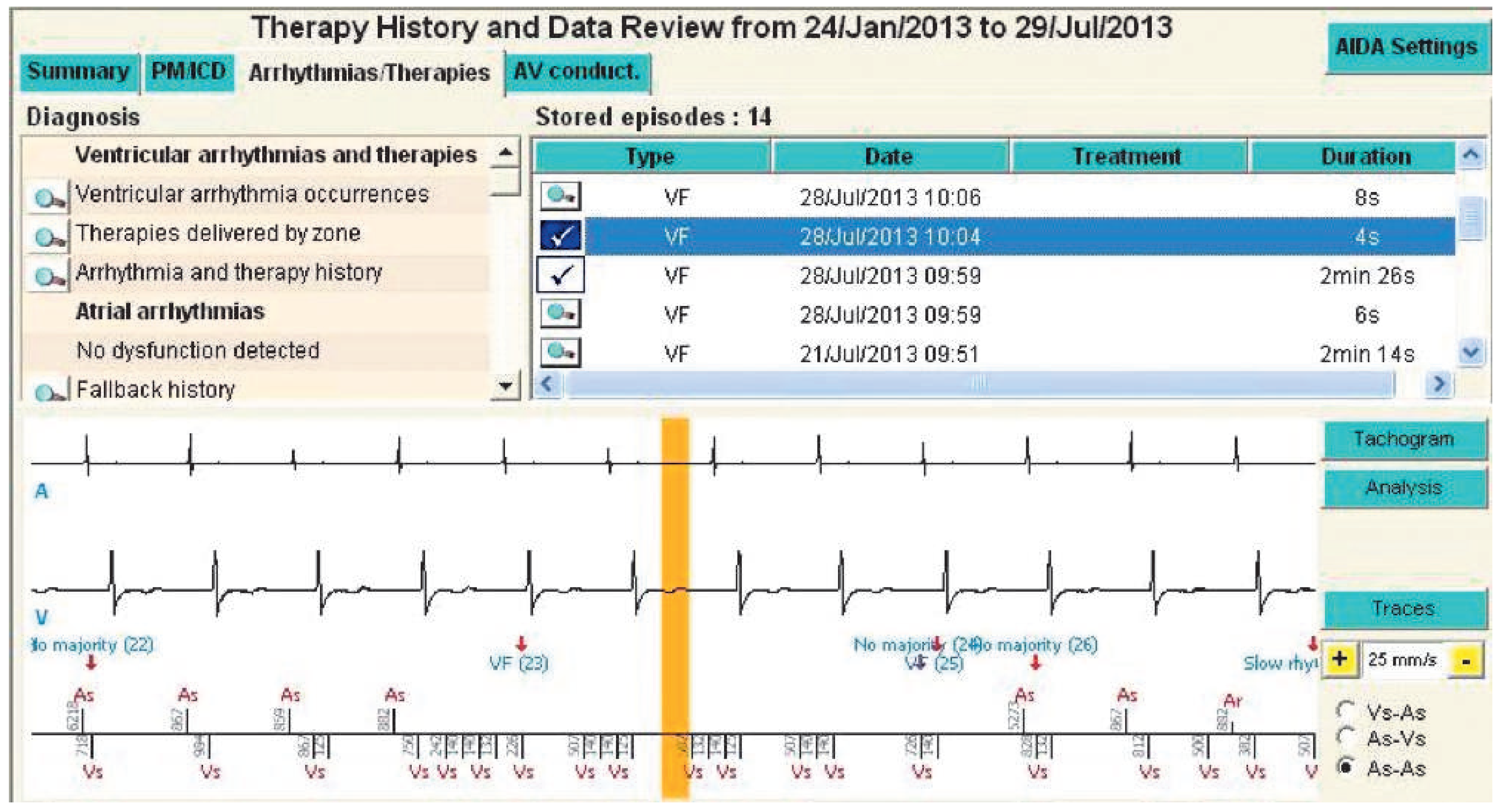 Cardiovascmed 17 00186 g002 Cardiovascmed 17 00186 g002