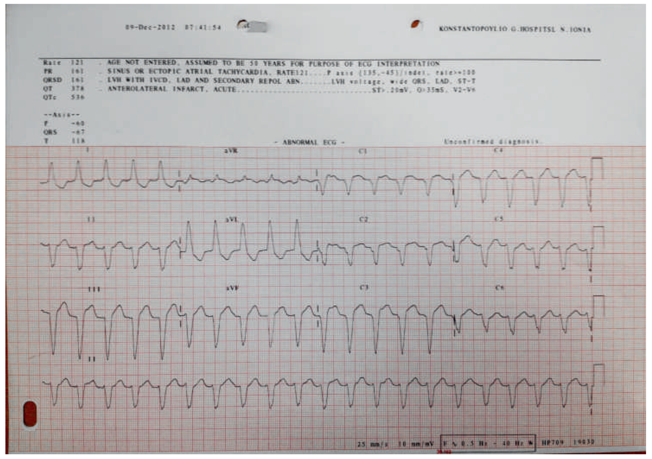 Cardiovascmed 17 00189 g001 Cardiovascmed 17 00189 g001