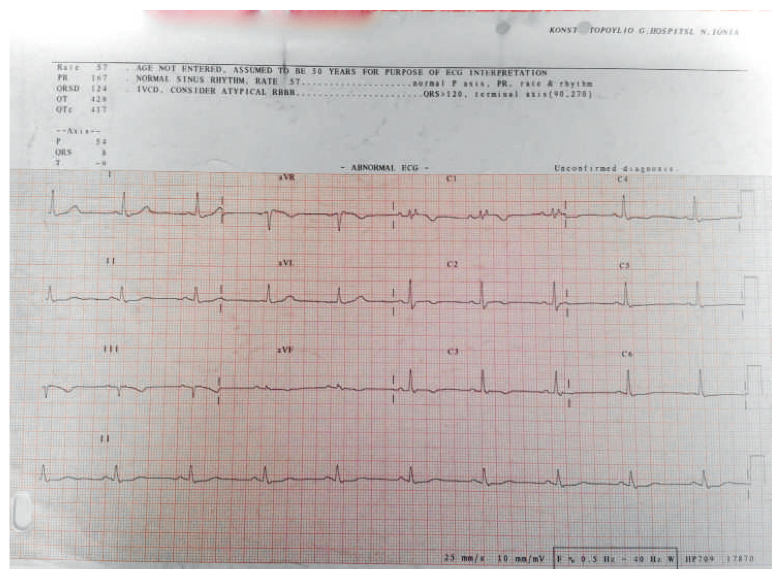 Cardiovascmed 17 00189 g002 Cardiovascmed 17 00189 g002