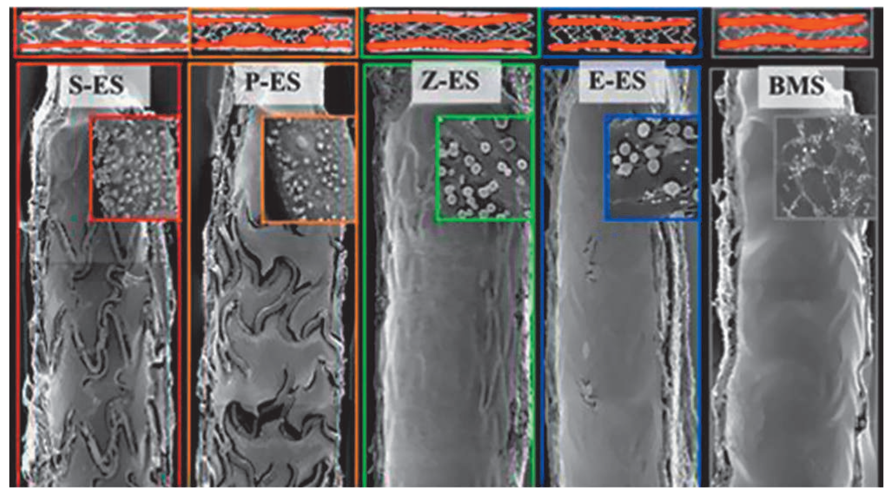 Cardiovascmed 17 00239 g002 Cardiovascmed 17 00239 g002