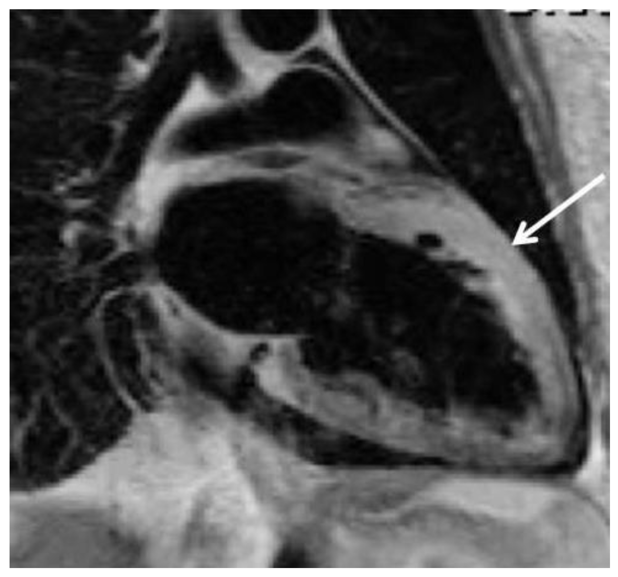 Cardiovascmed 17 00245 g001 Cardiovascmed 17 00245 g001