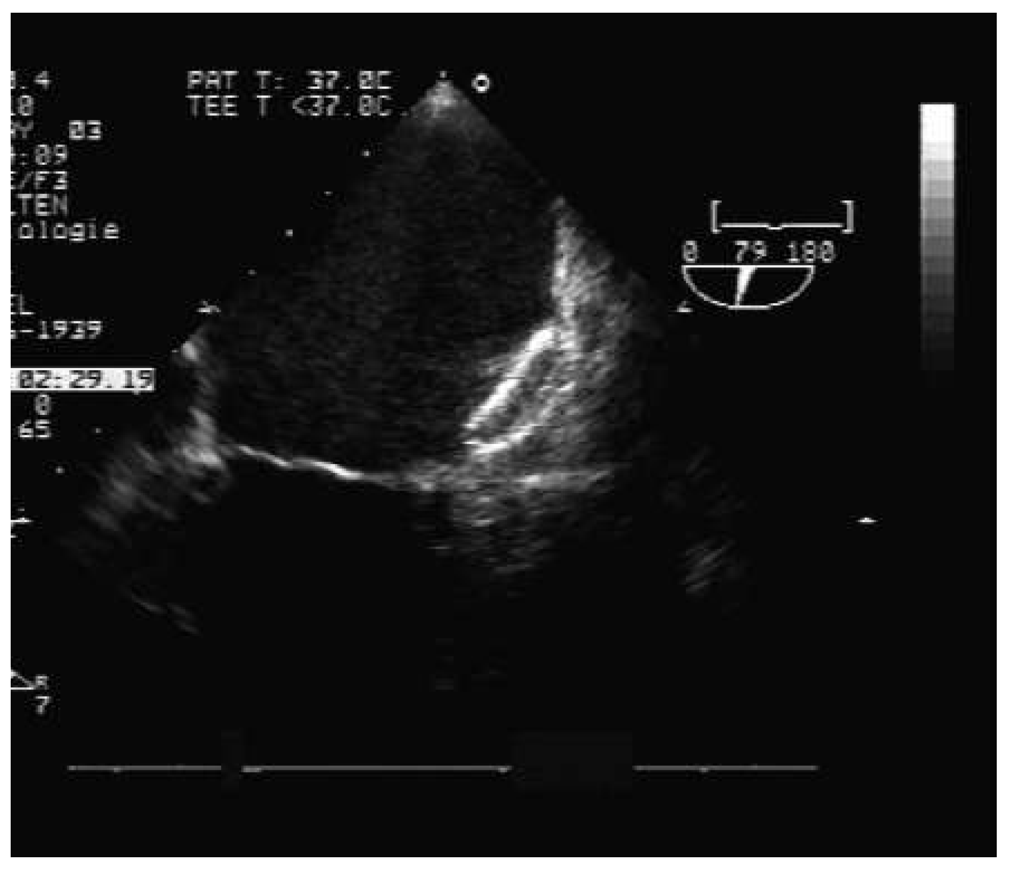 Cardiovascmed 17 00252 g001 Cardiovascmed 17 00252 g001
