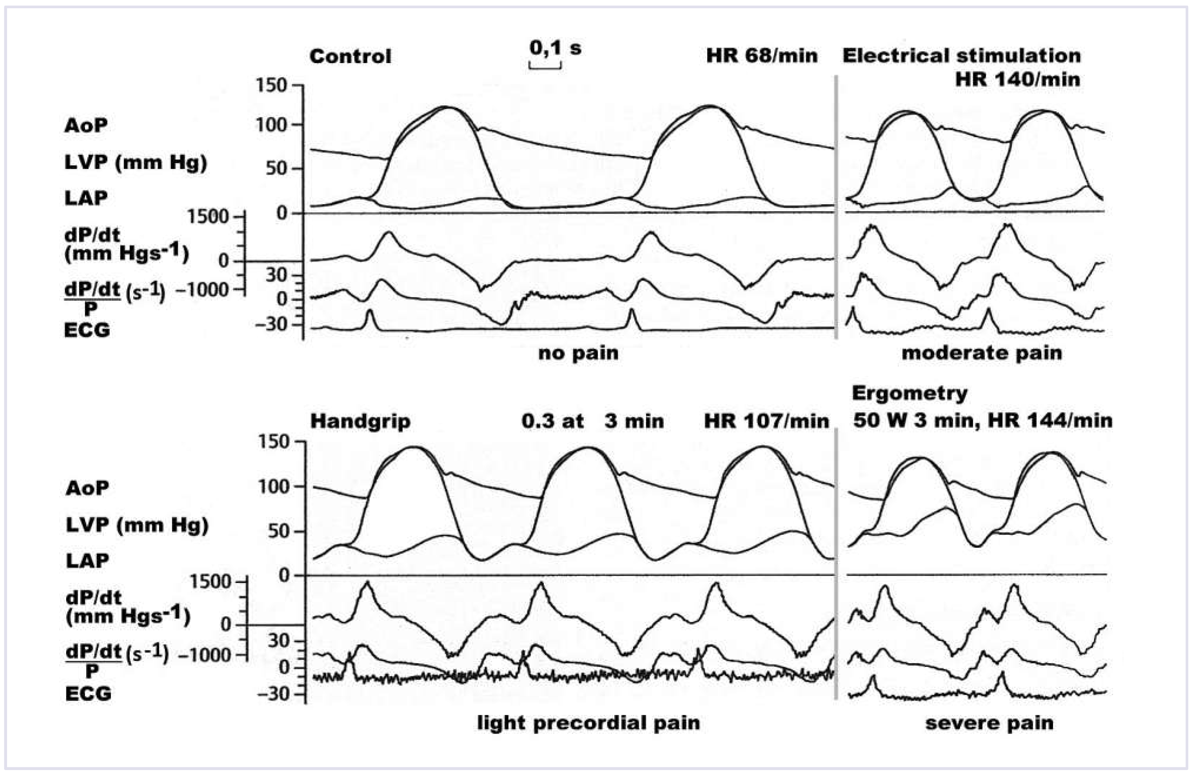 Cardiovascmed 17 00256 g006