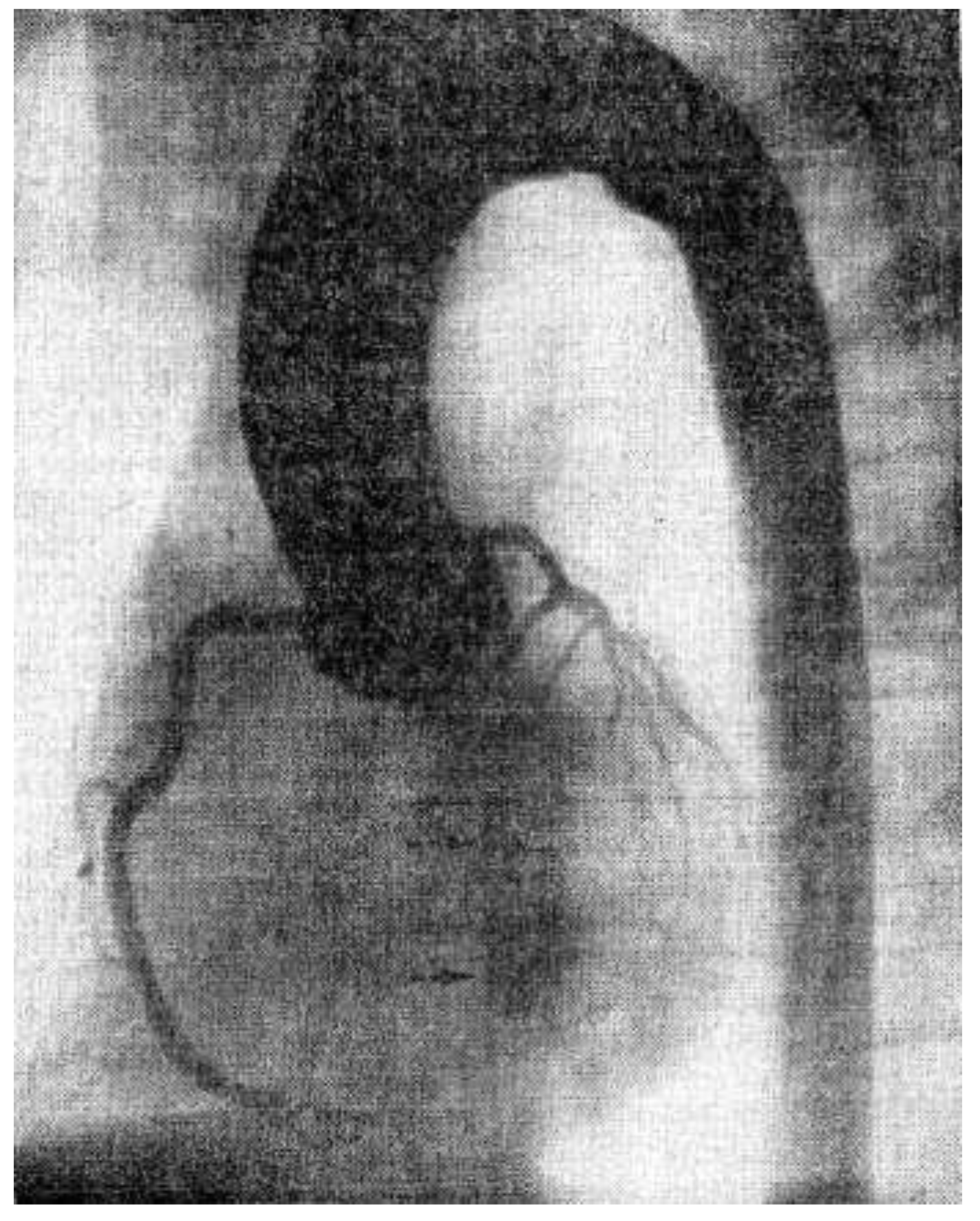 Cardiovascmed 17 00256 g007