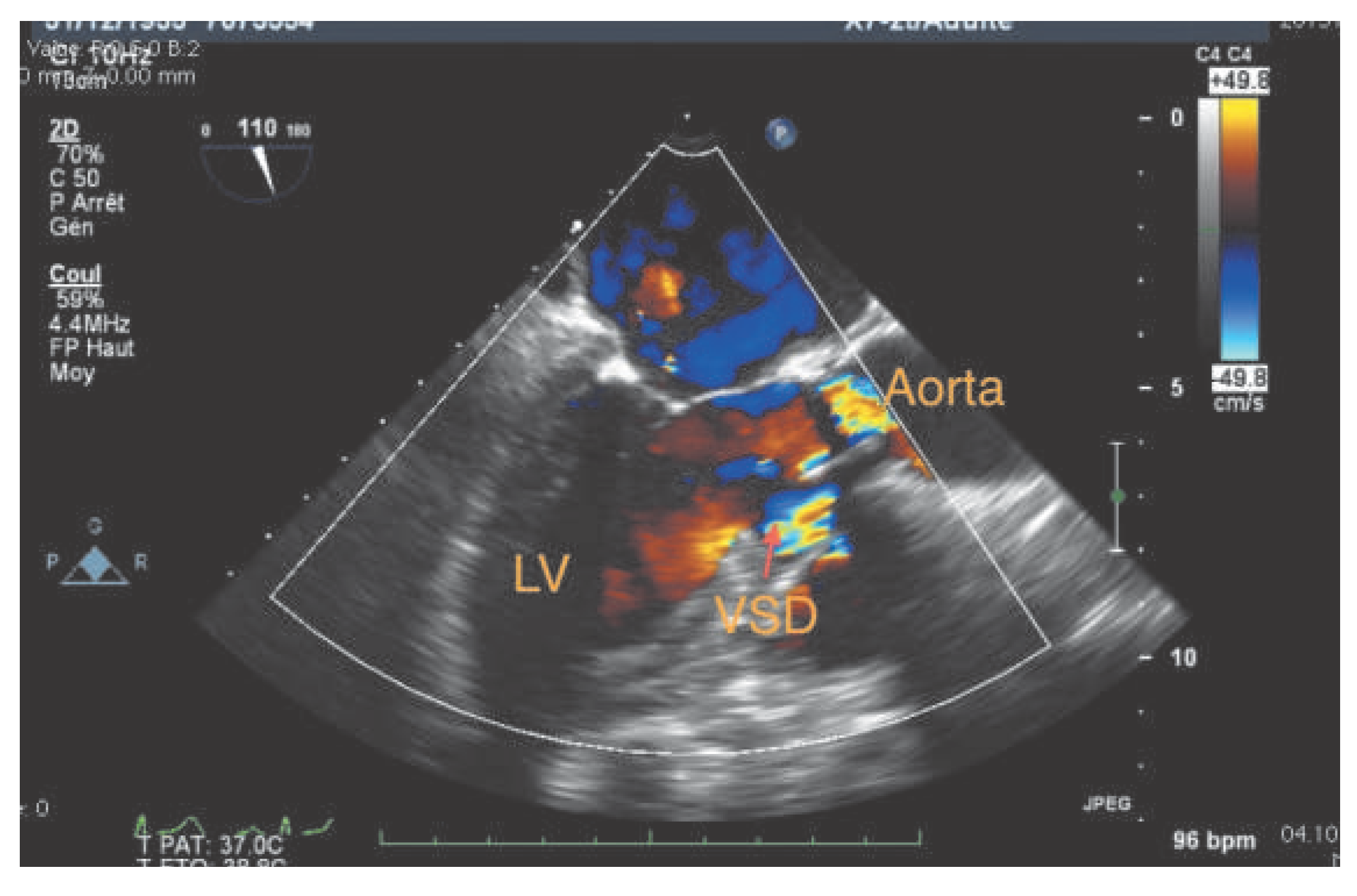 Cardiovascmed 17 00266 g001 Cardiovascmed 17 00266 g001