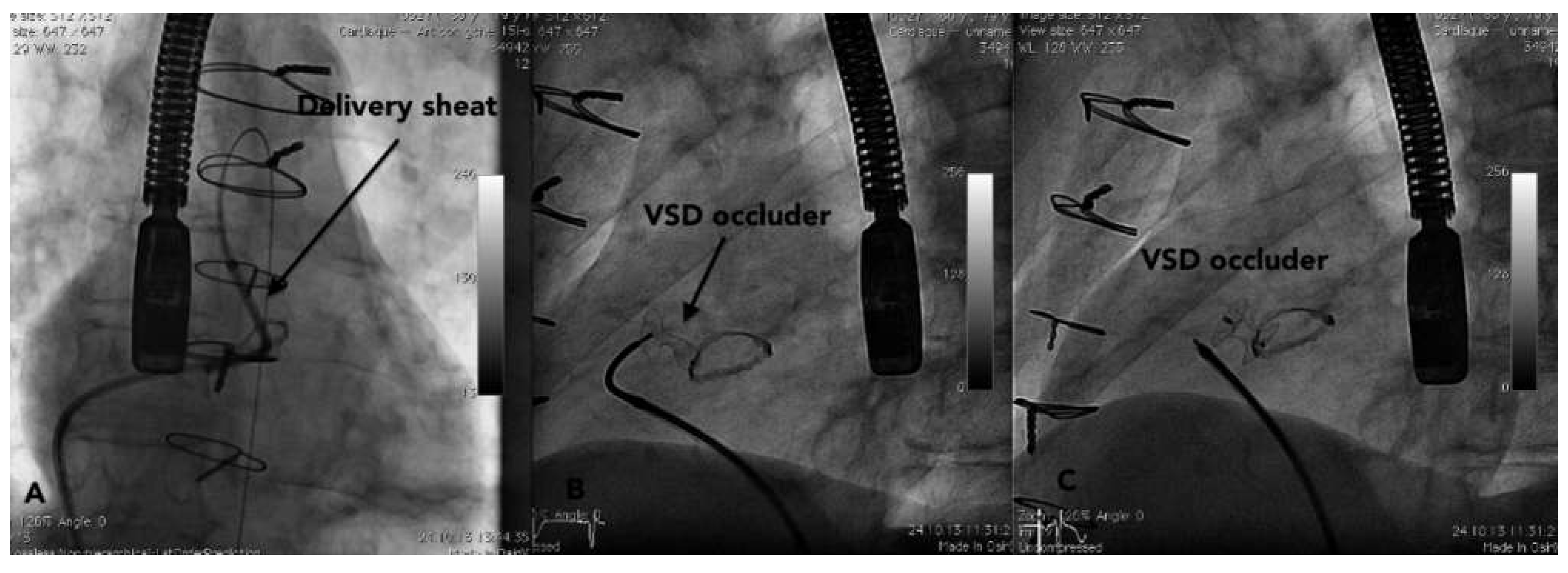 Cardiovascmed 17 00266 g003 Cardiovascmed 17 00266 g003