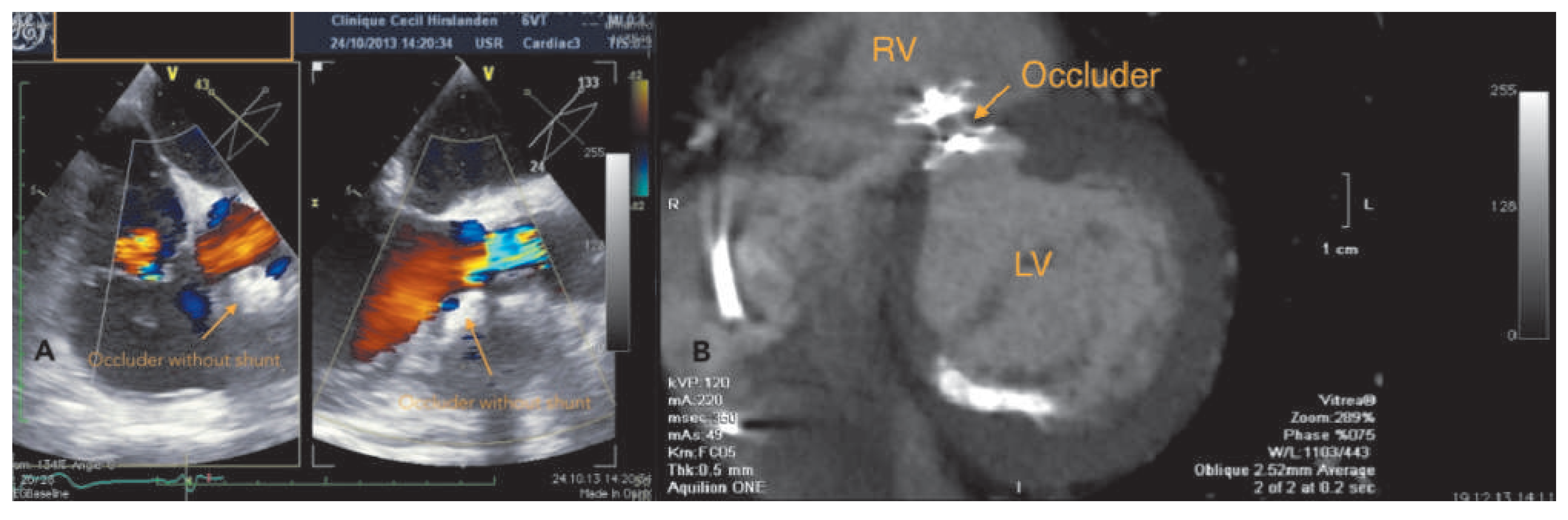 Cardiovascmed 17 00266 g004 Cardiovascmed 17 00266 g004