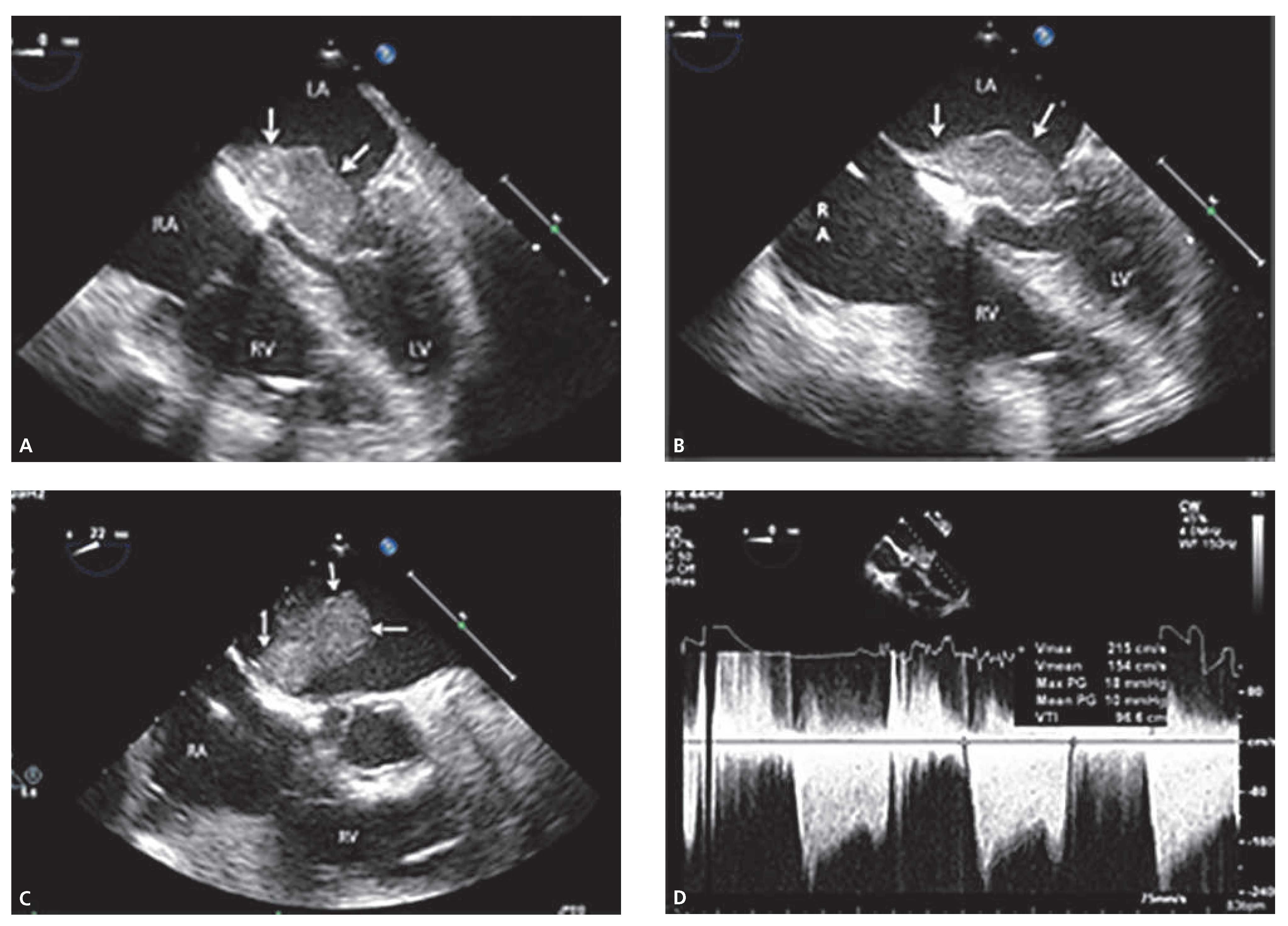 Cardiovascmed 17 00269 g001 Cardiovascmed 17 00269 g001