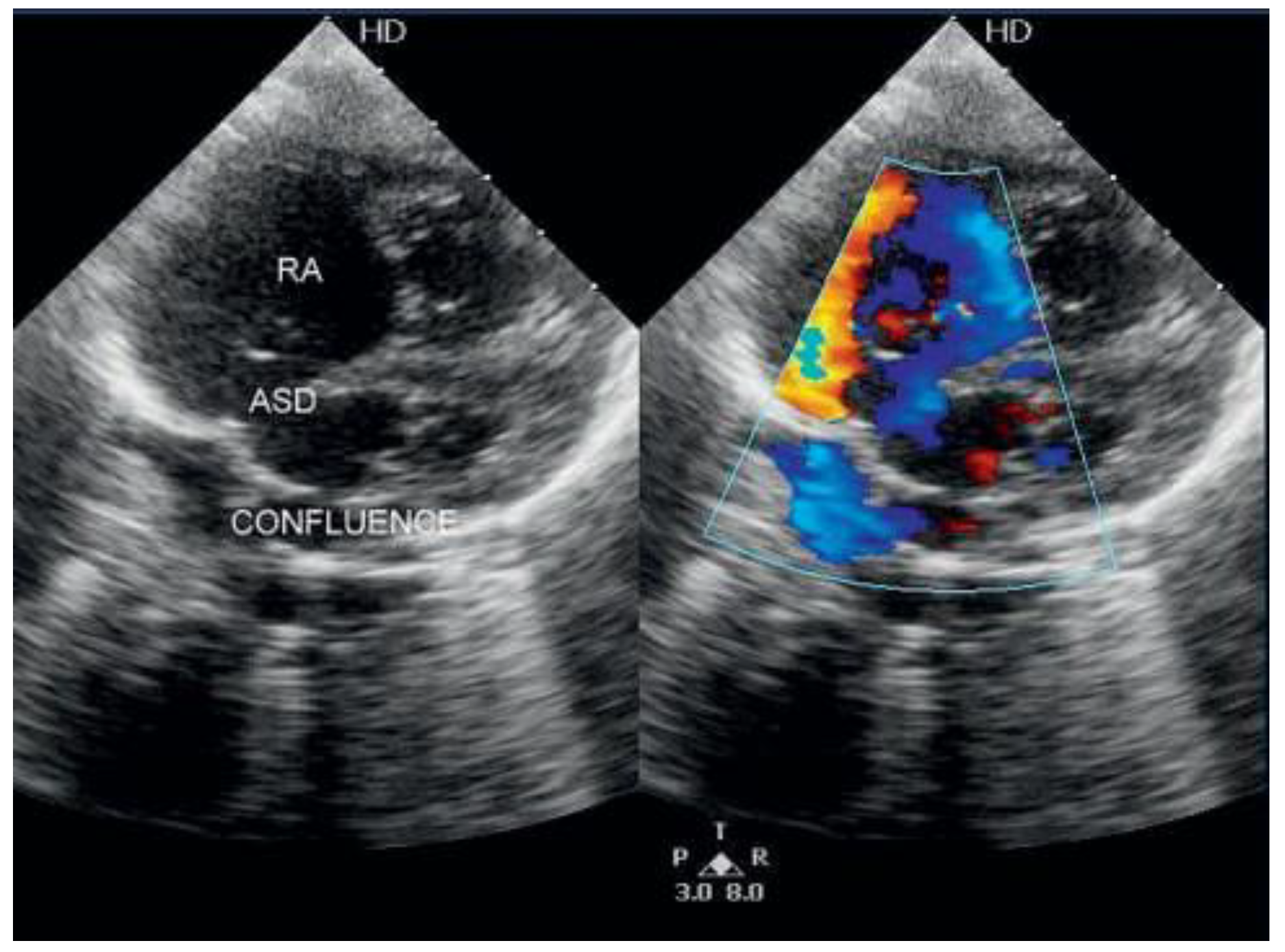 Cardiovascmed 17 00273 g001 Cardiovascmed 17 00273 g001