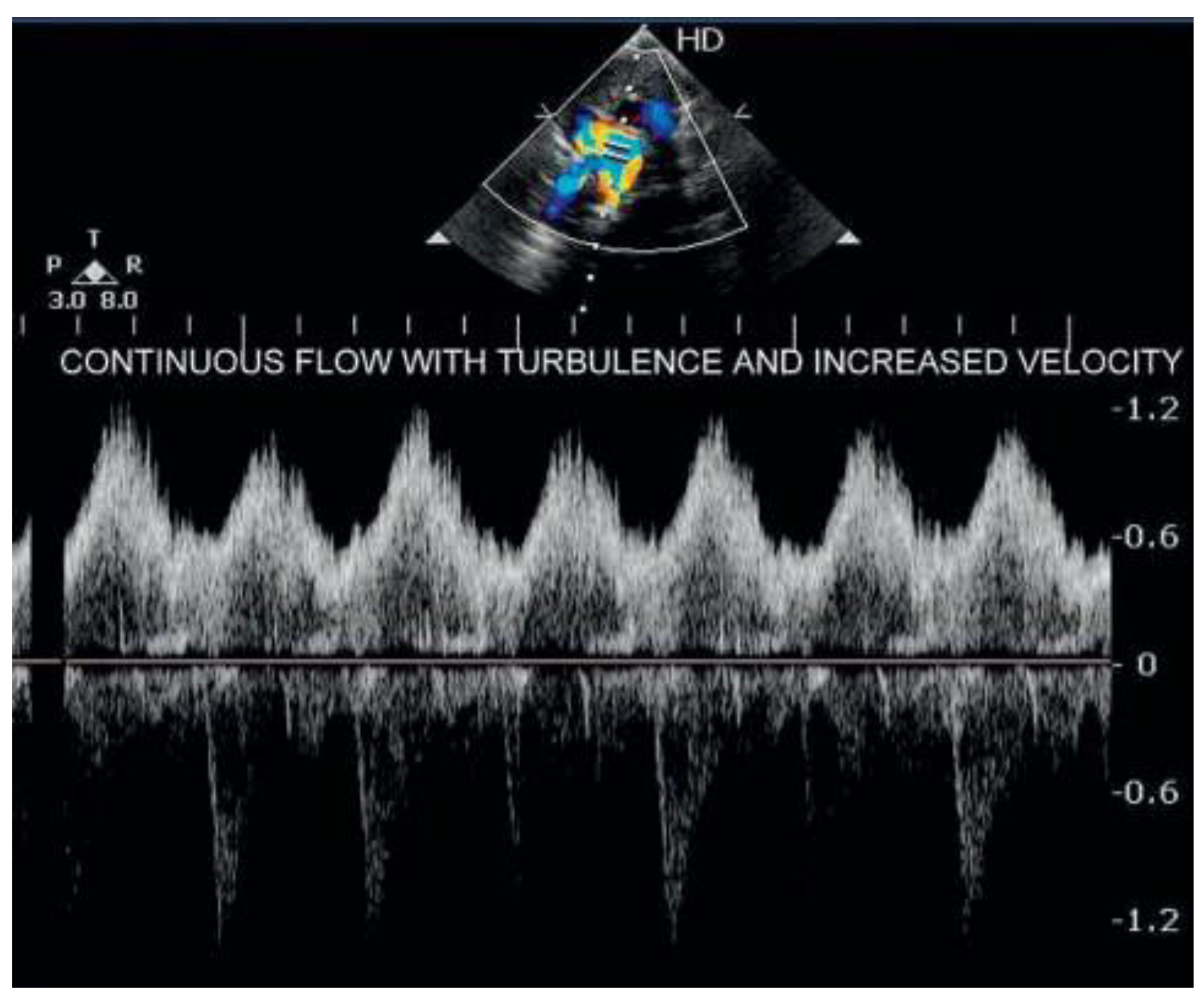 Cardiovascmed 17 00273 g002 Cardiovascmed 17 00273 g002