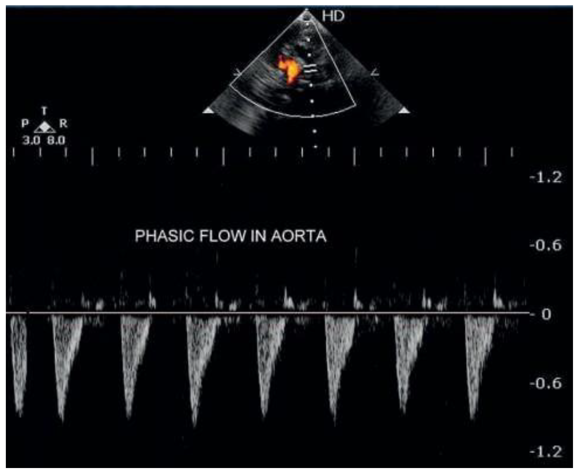 Cardiovascmed 17 00273 g003 Cardiovascmed 17 00273 g003