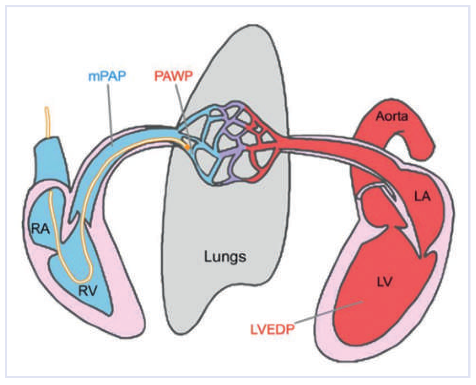Cardiovascmed 17 00312 g001