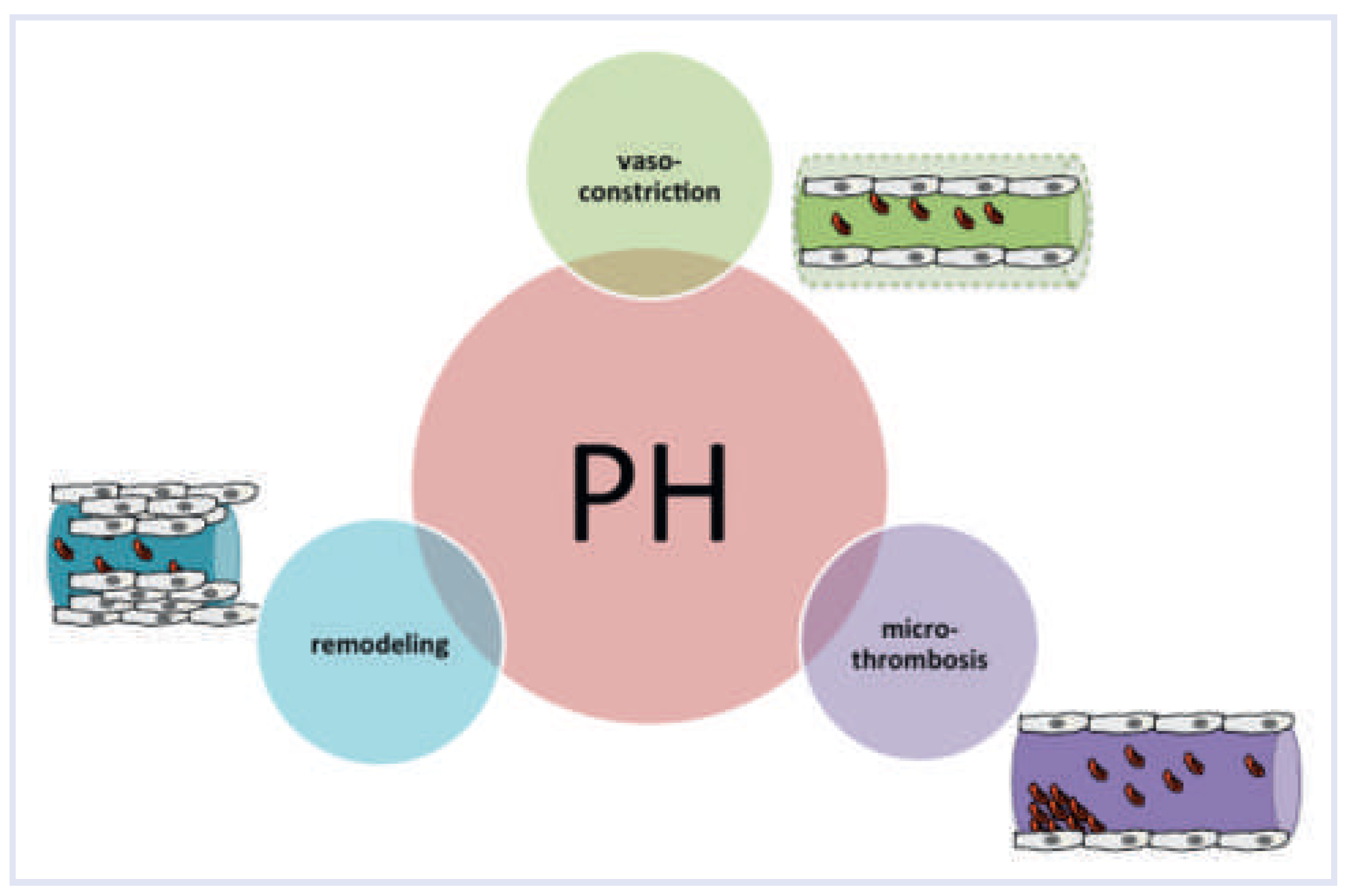 Cardiovascmed 17 00312 g004