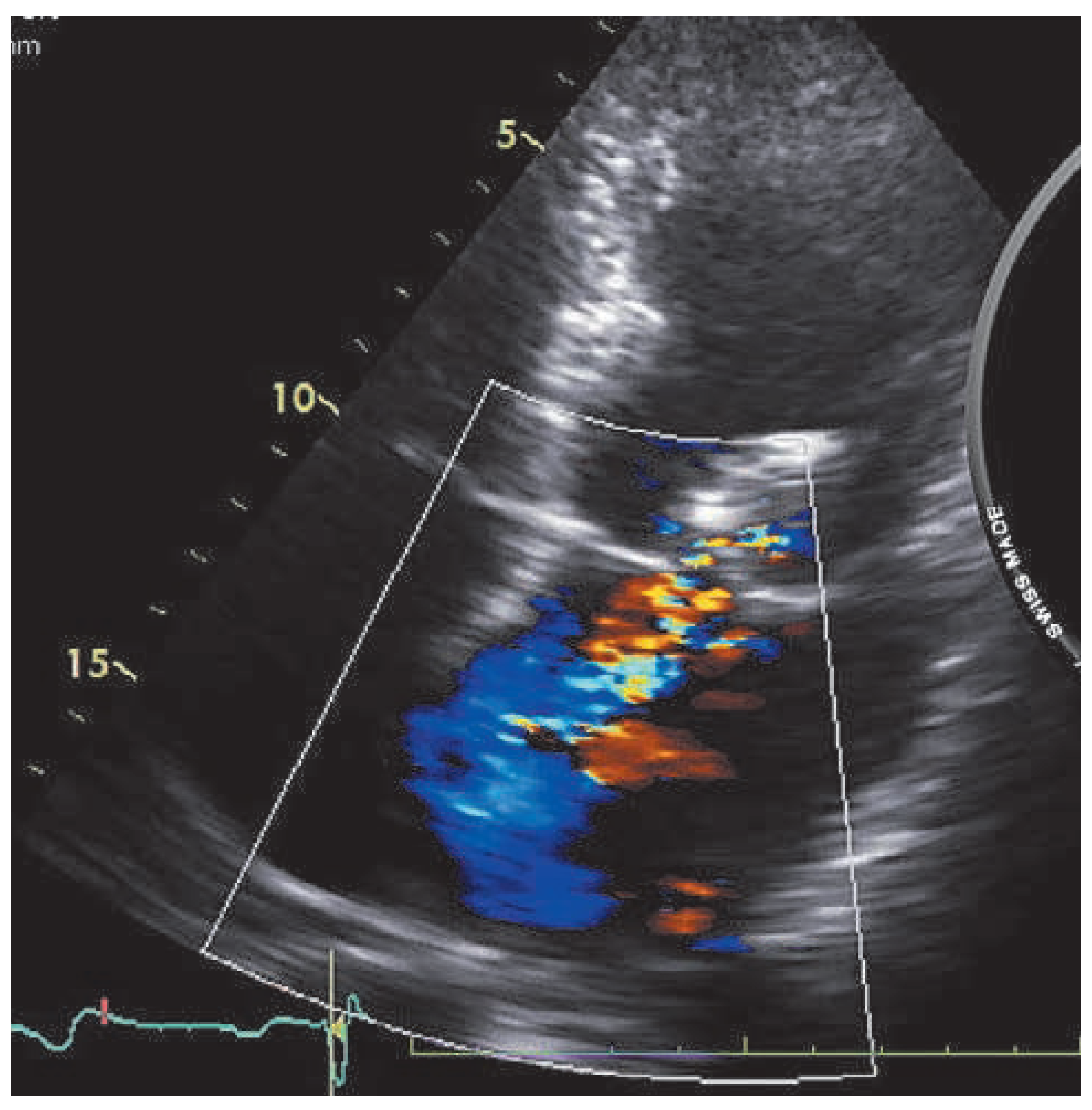 Cardiovascmed 17 00371 g001 Cardiovascmed 17 00371 g001