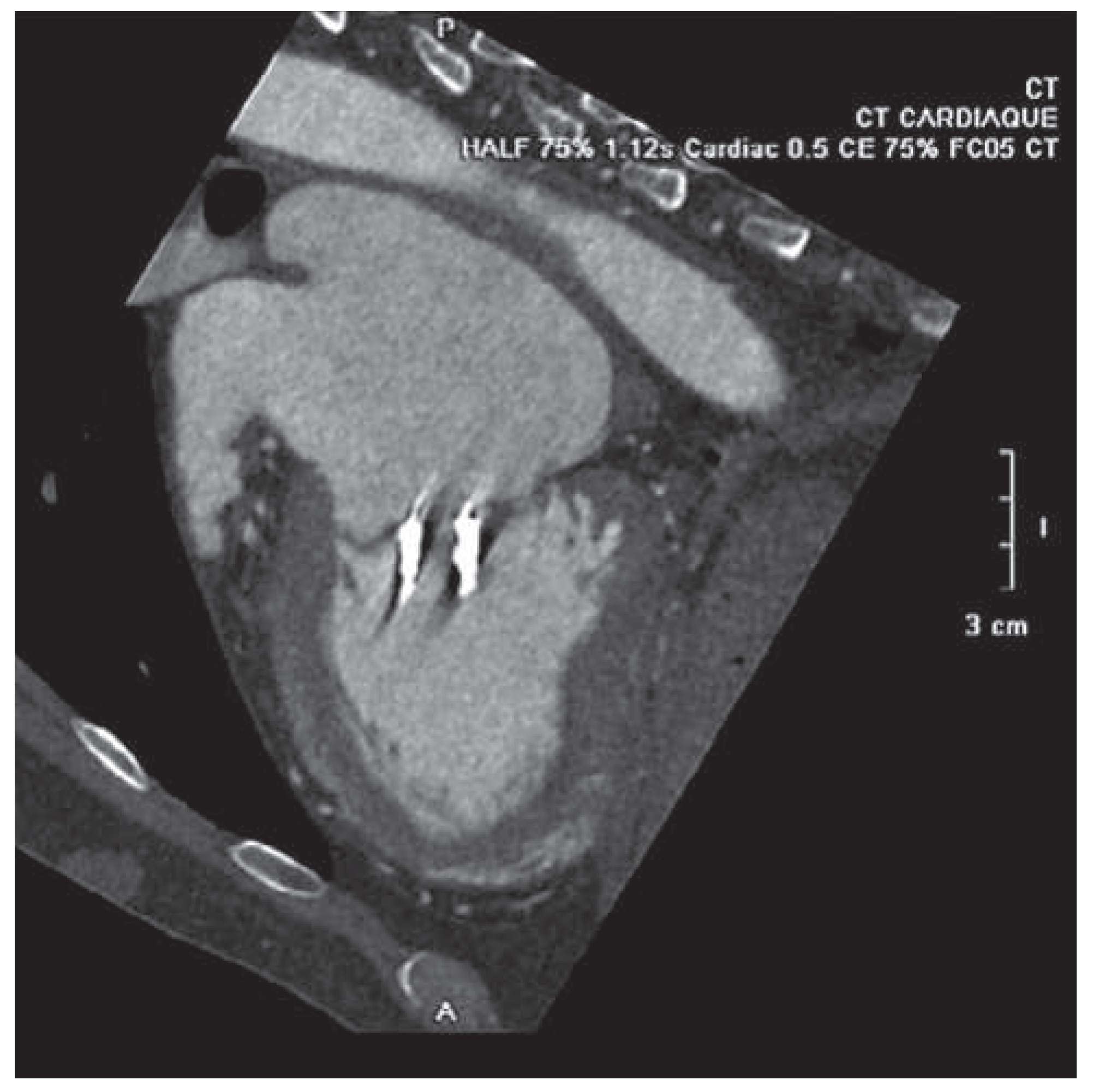 Cardiovascmed 17 00371 g002 Cardiovascmed 17 00371 g002