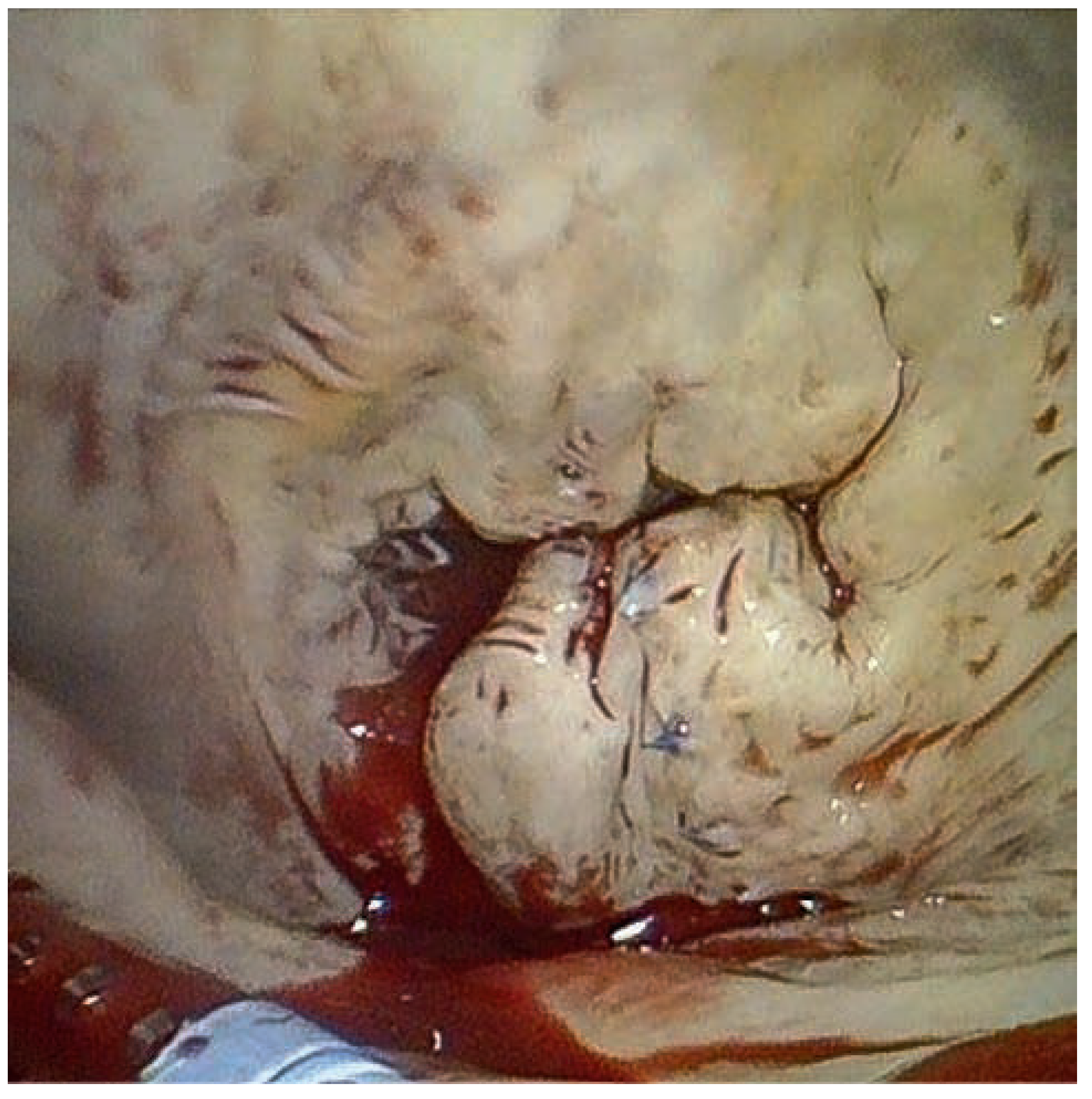 Cardiovascmed 17 00371 g004 Cardiovascmed 17 00371 g004