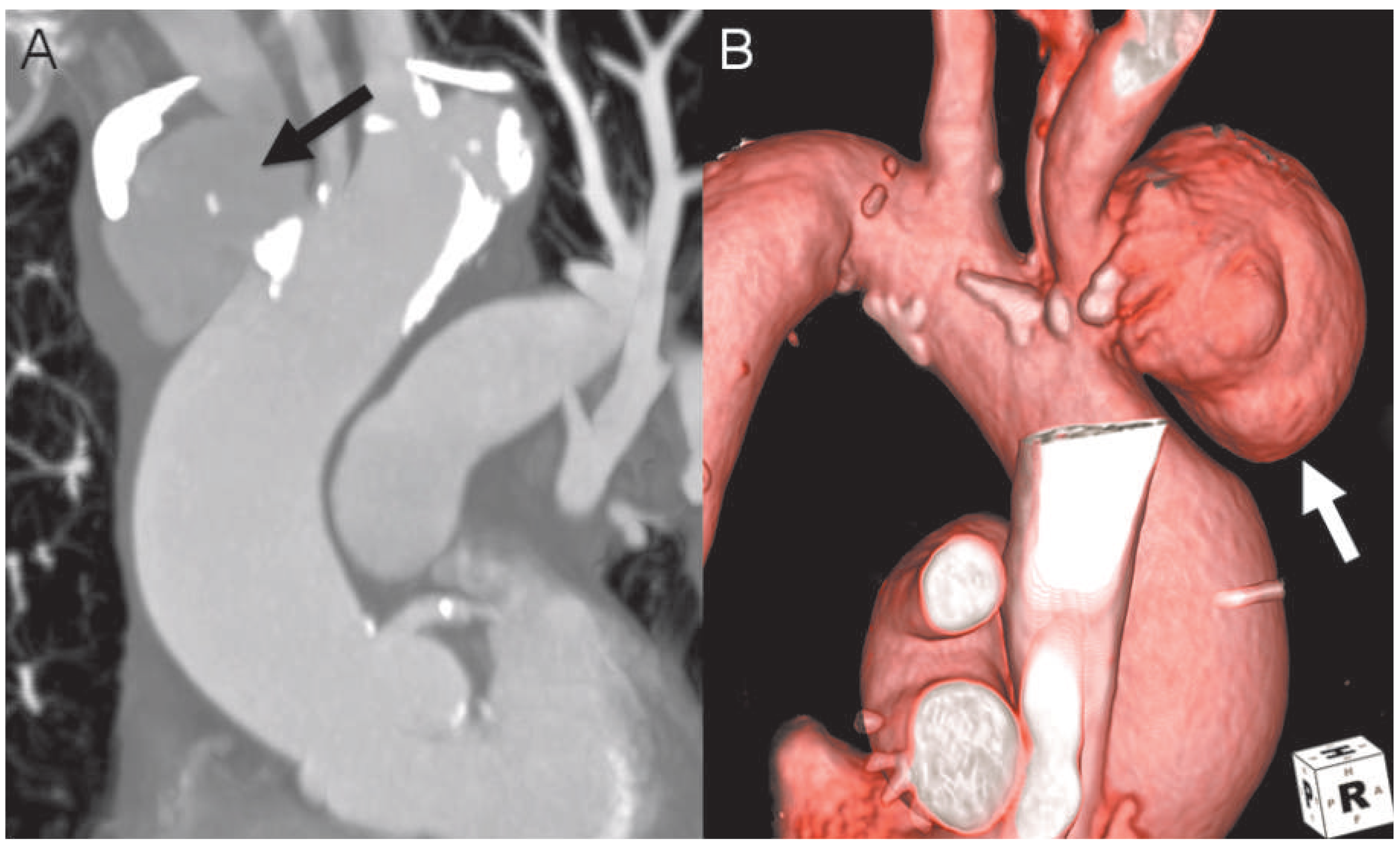 Cardiovascmed 18 00068 g001