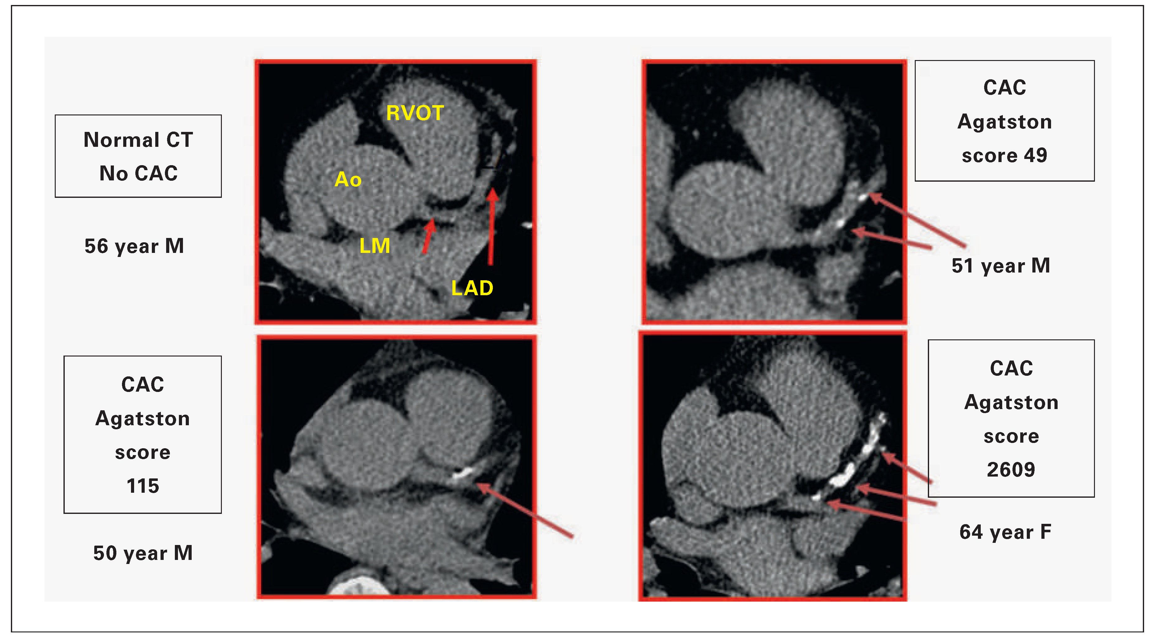 Cardiovascmed 18 00075 g002