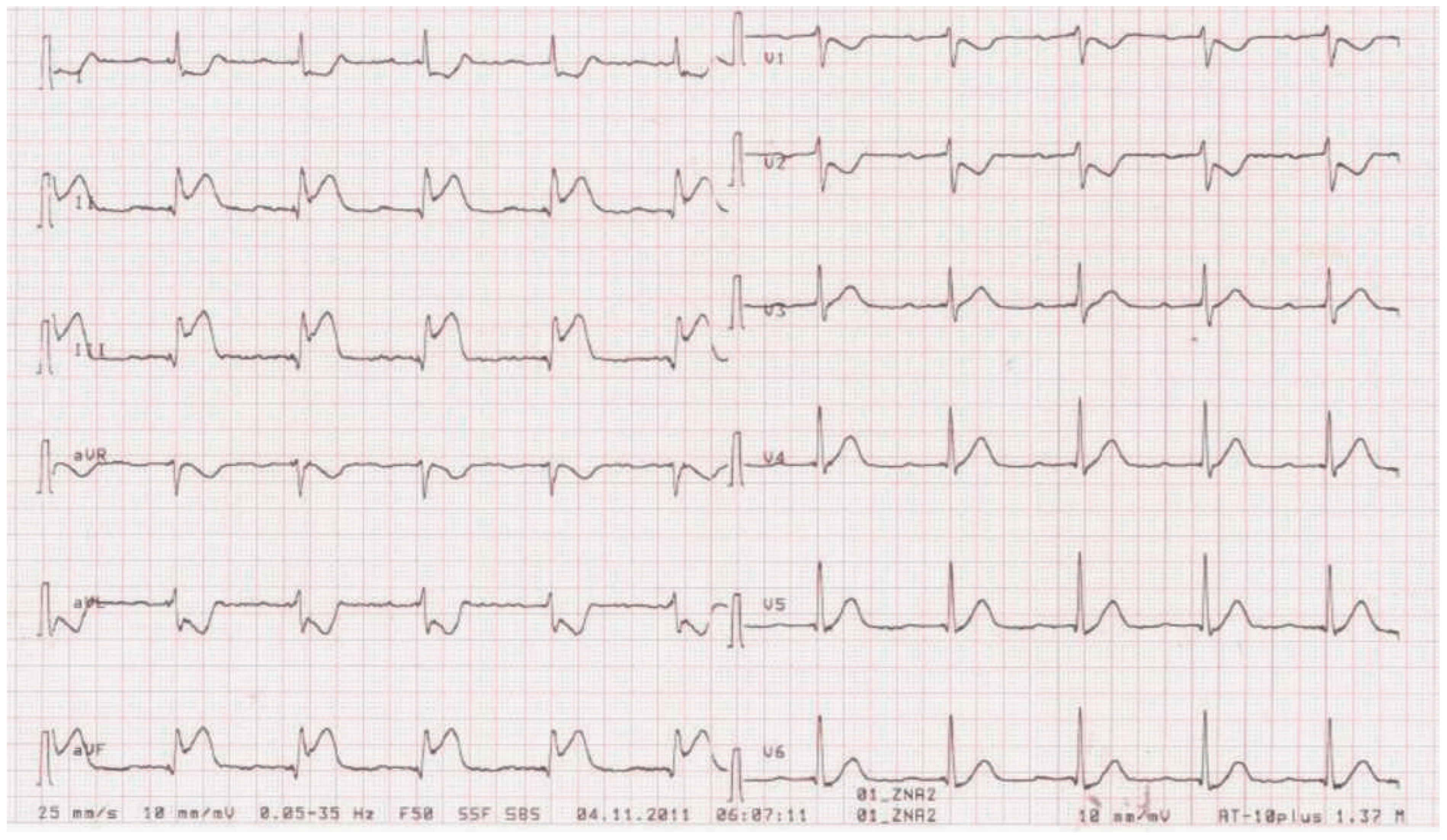 Cardiovascmed 18 00107 g002