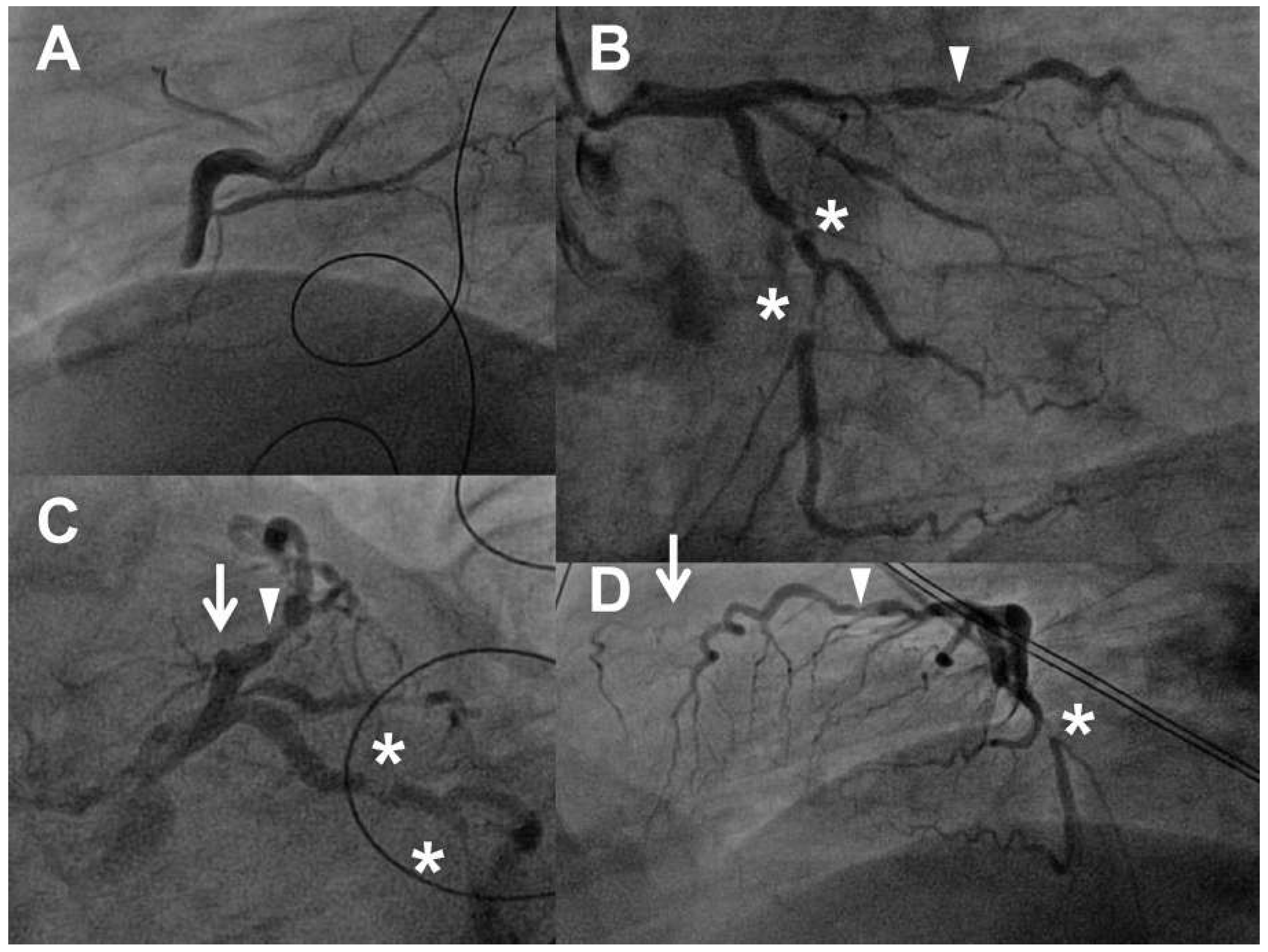 Cardiovascmed 18 00107 g004