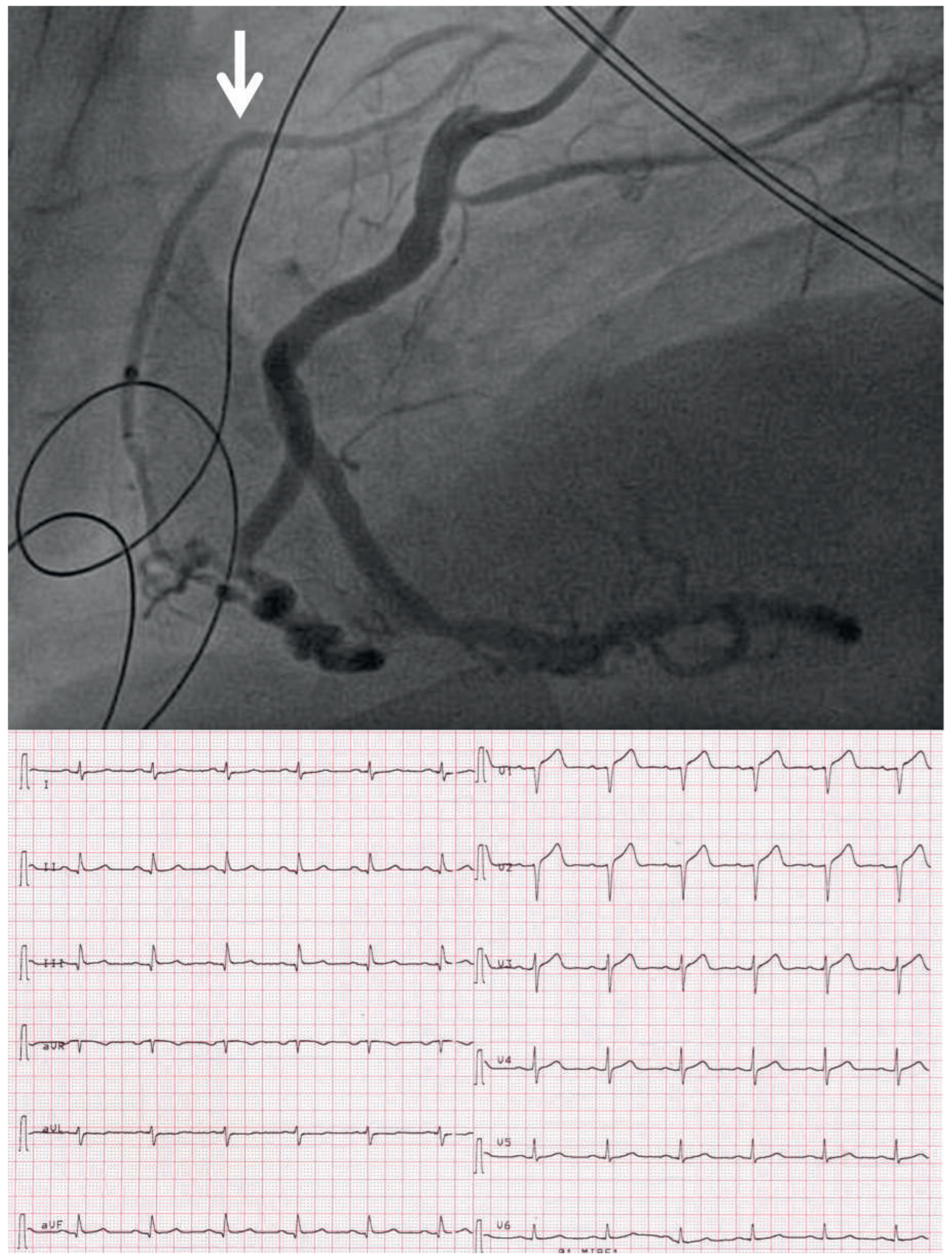 Cardiovascmed 18 00107 g005