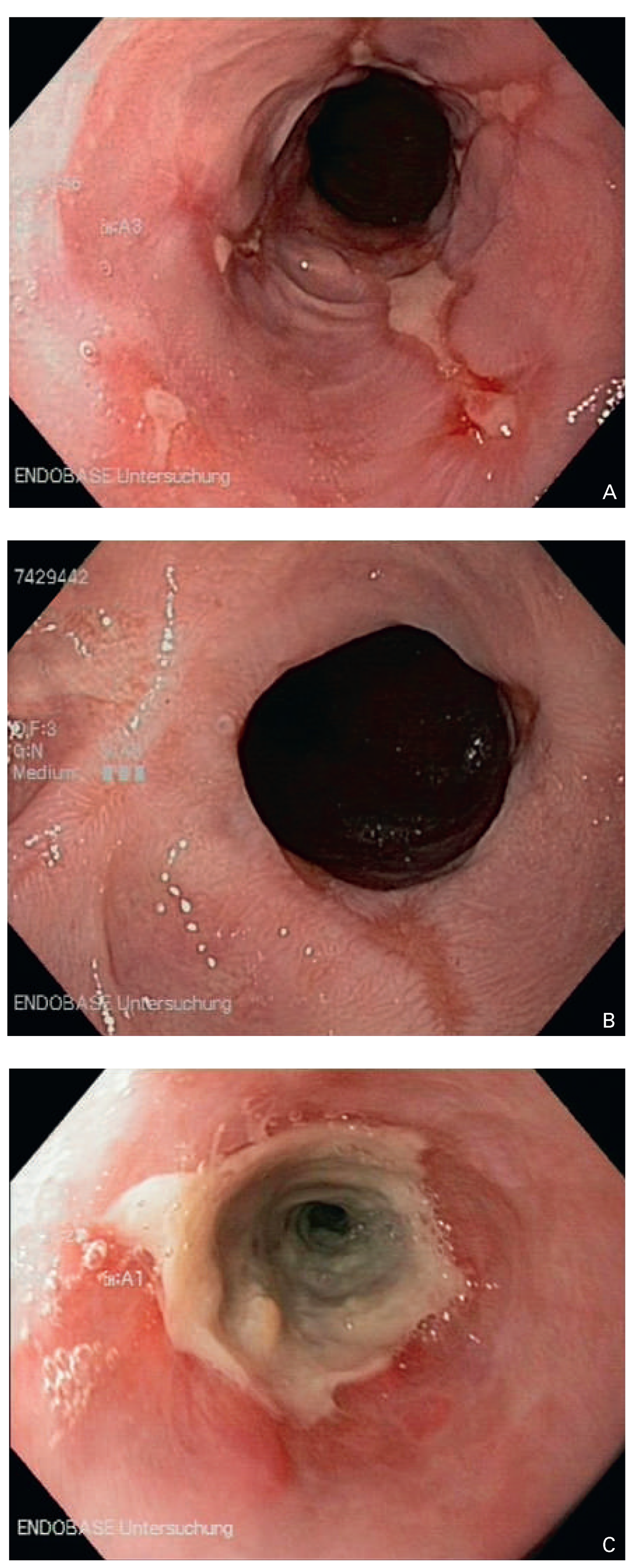 Cardiovascmed 18 00120 g001