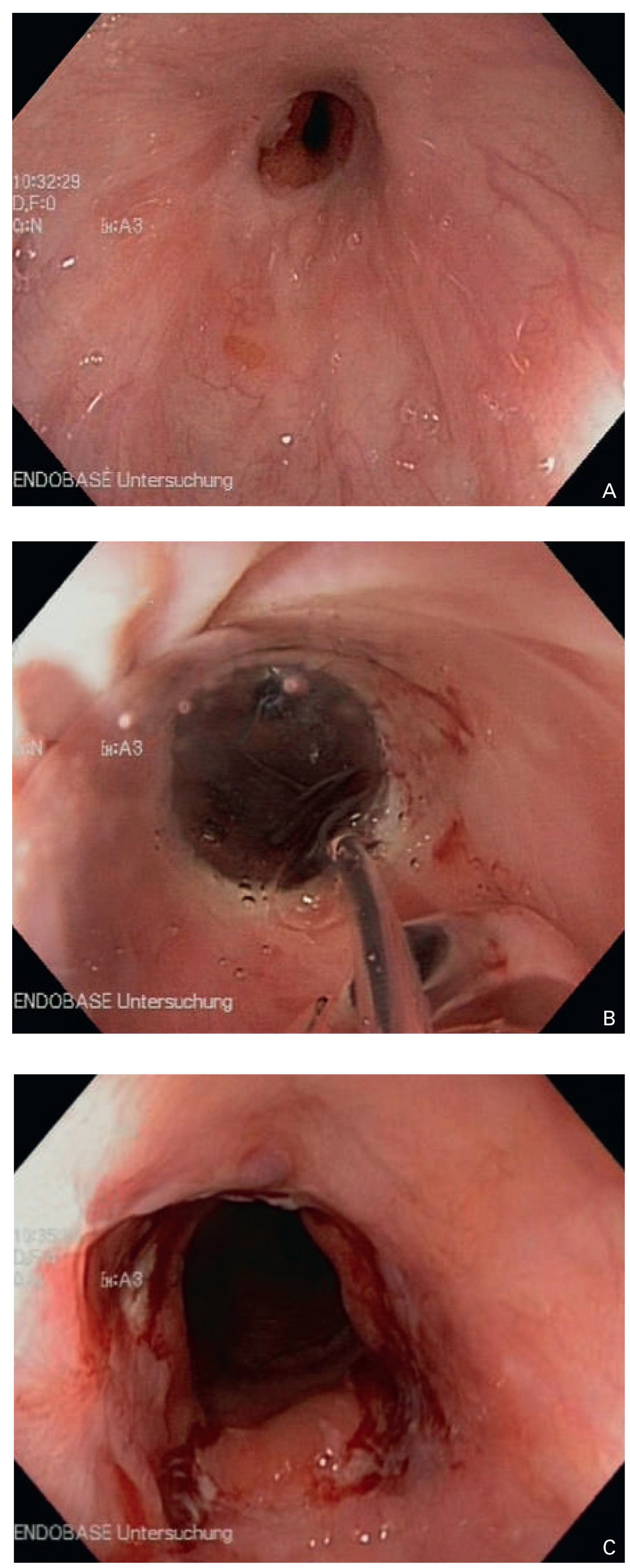 Cardiovascmed 18 00120 g002