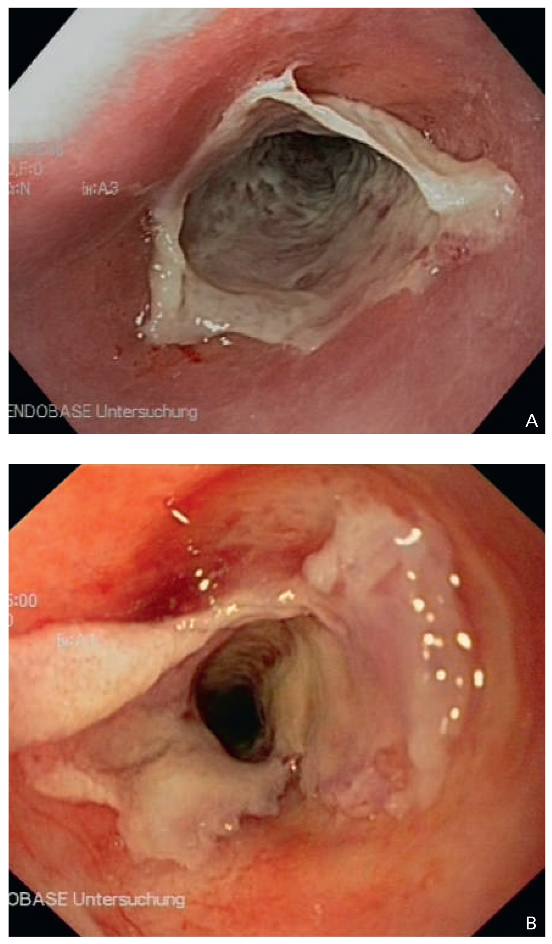 Cardiovascmed 18 00120 g004