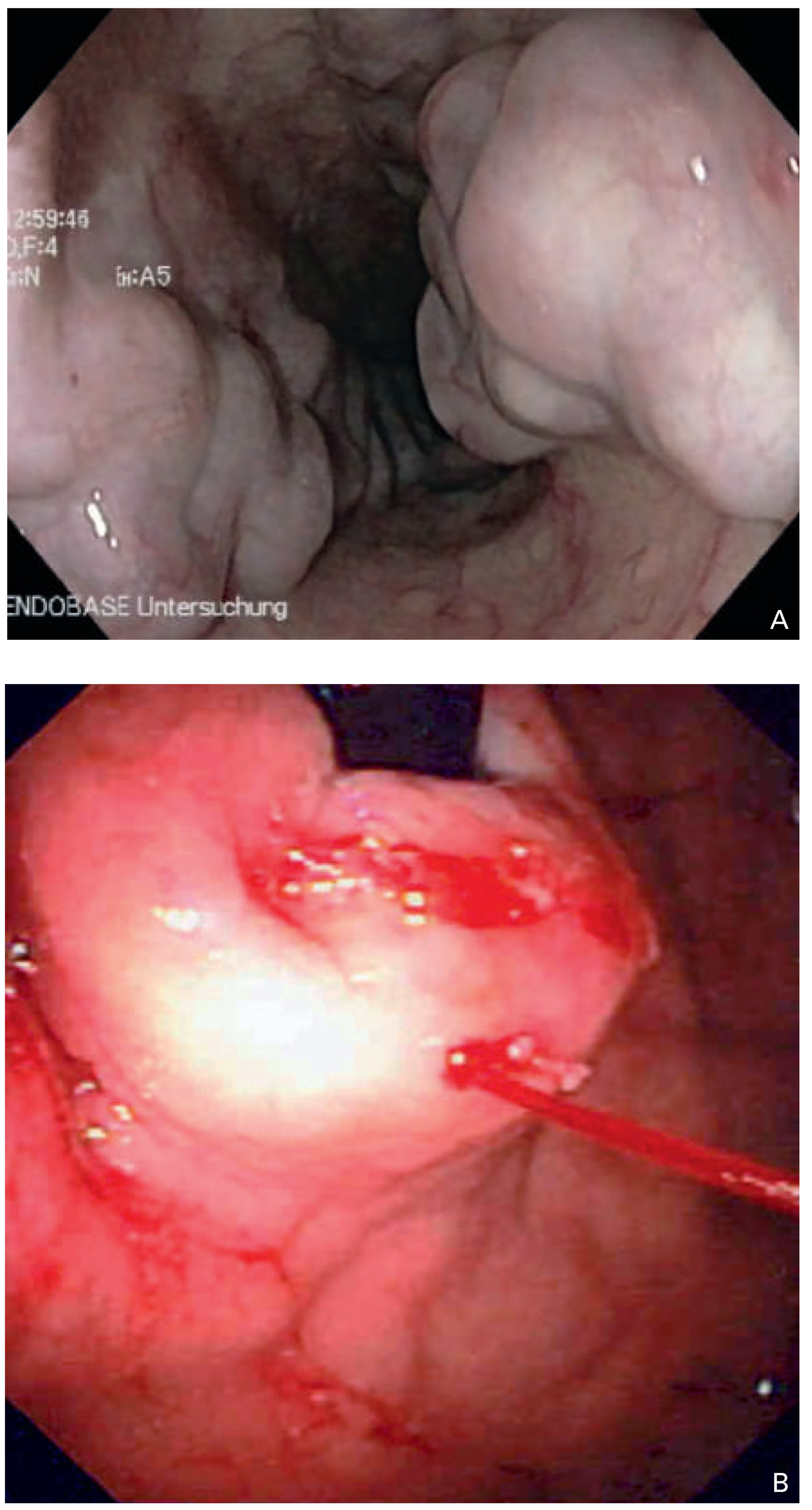 Cardiovascmed 18 00120 g005
