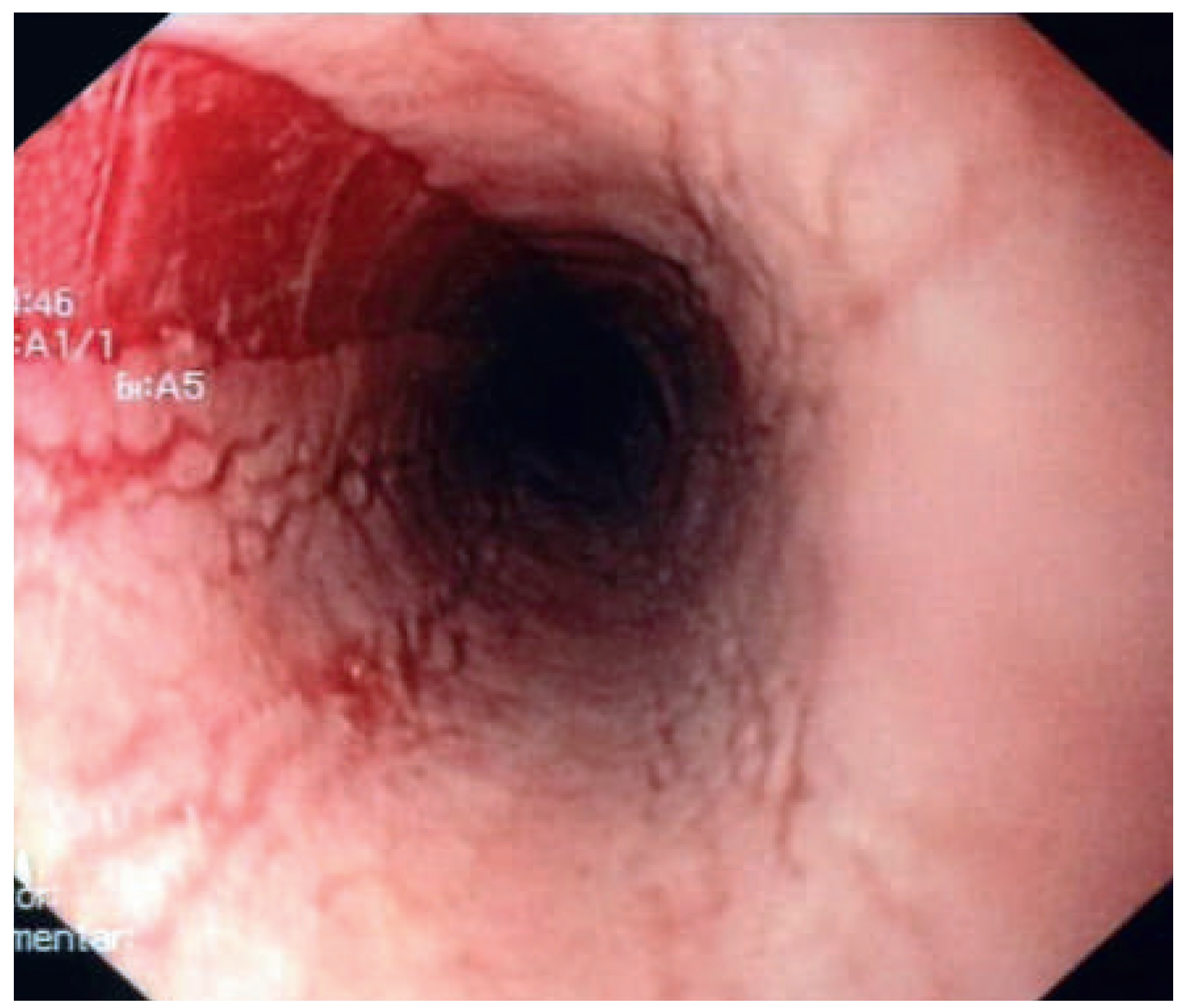 Cardiovascmed 18 00120 g006