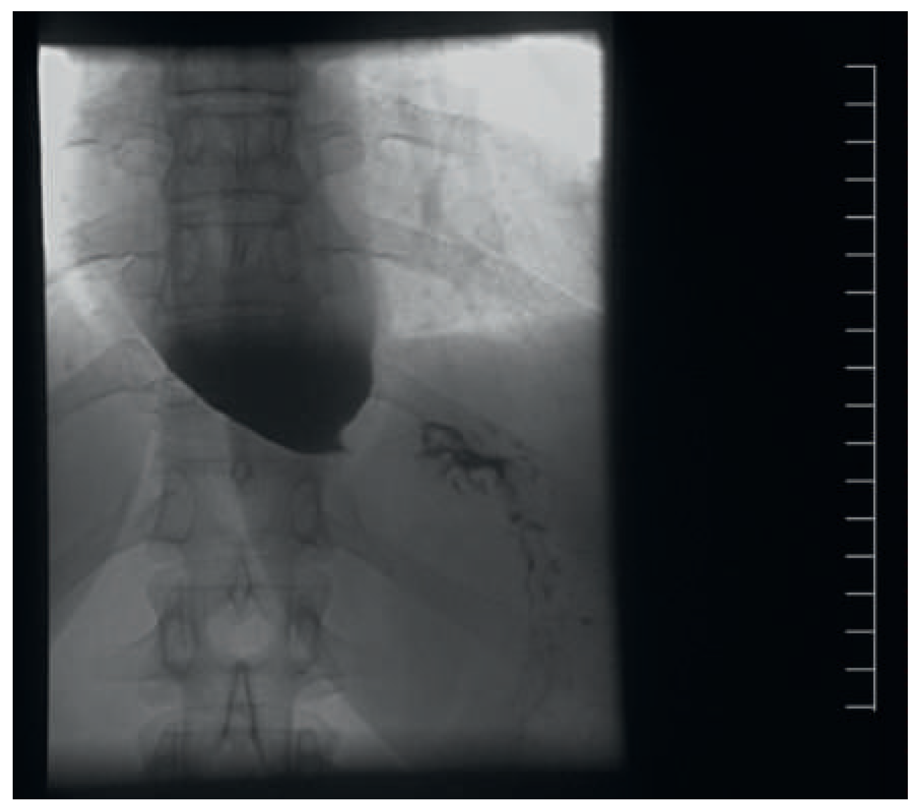 Cardiovascmed 18 00120 g007