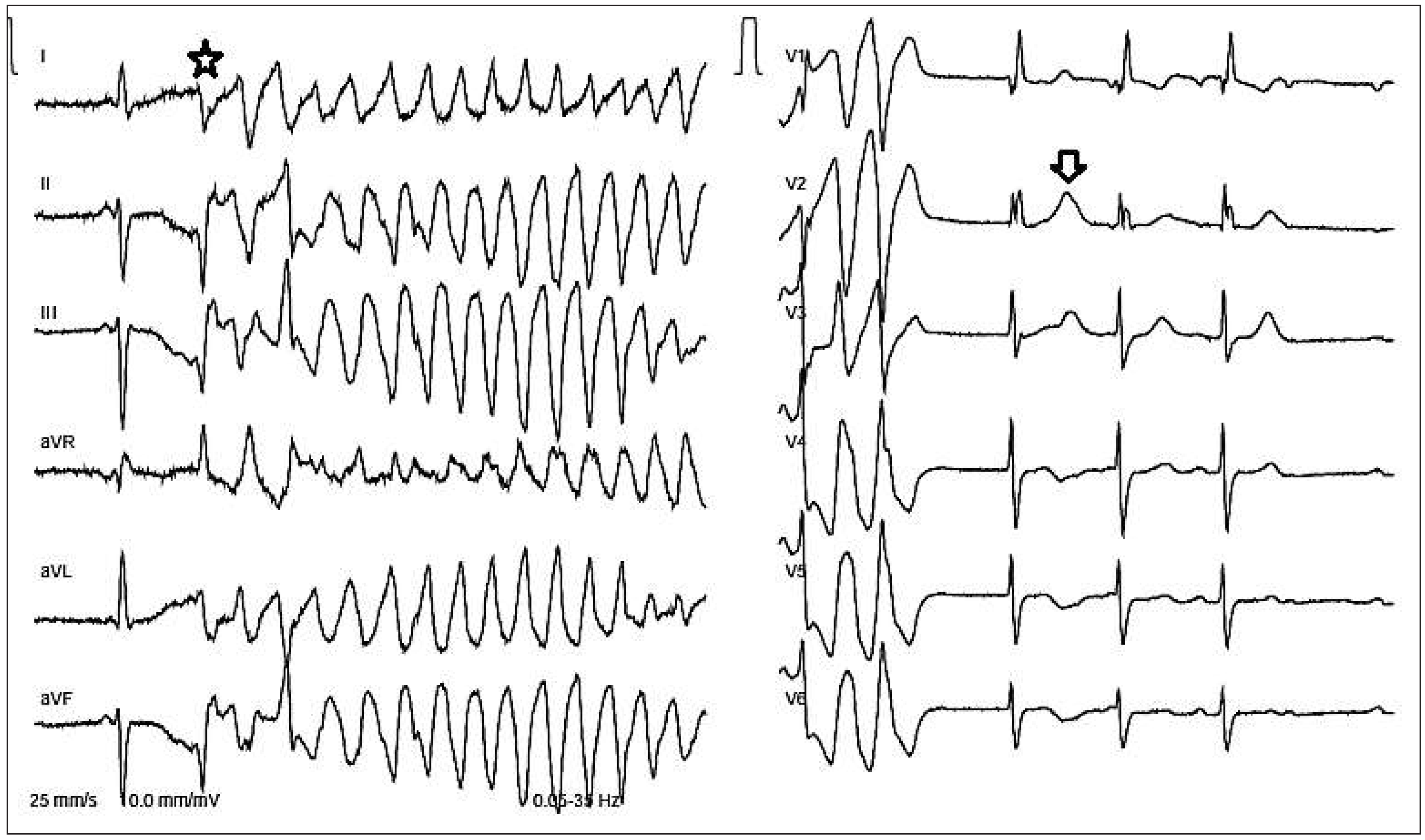 Cardiovascmed 18 00142 g001