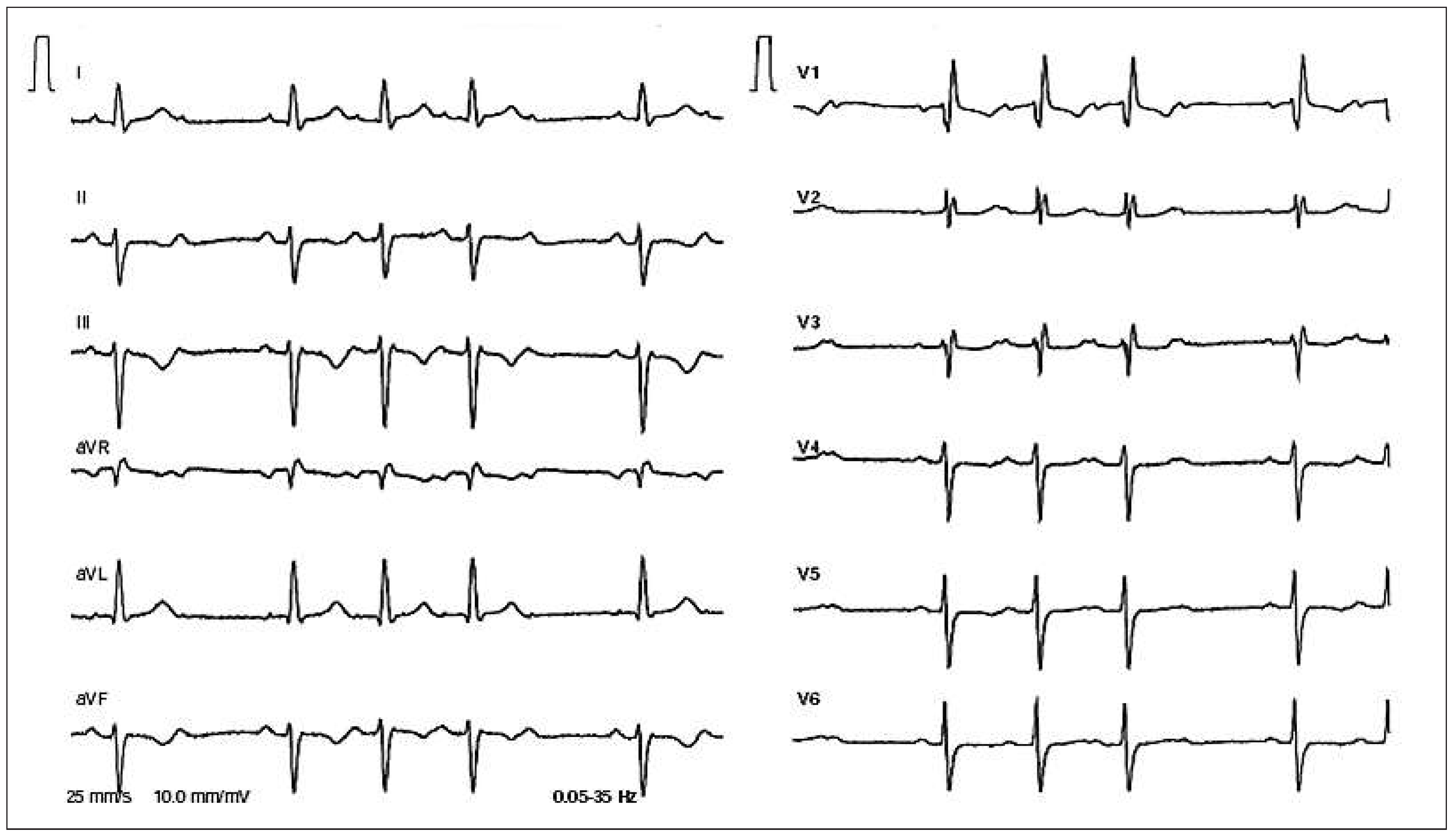 Cardiovascmed 18 00142 g002