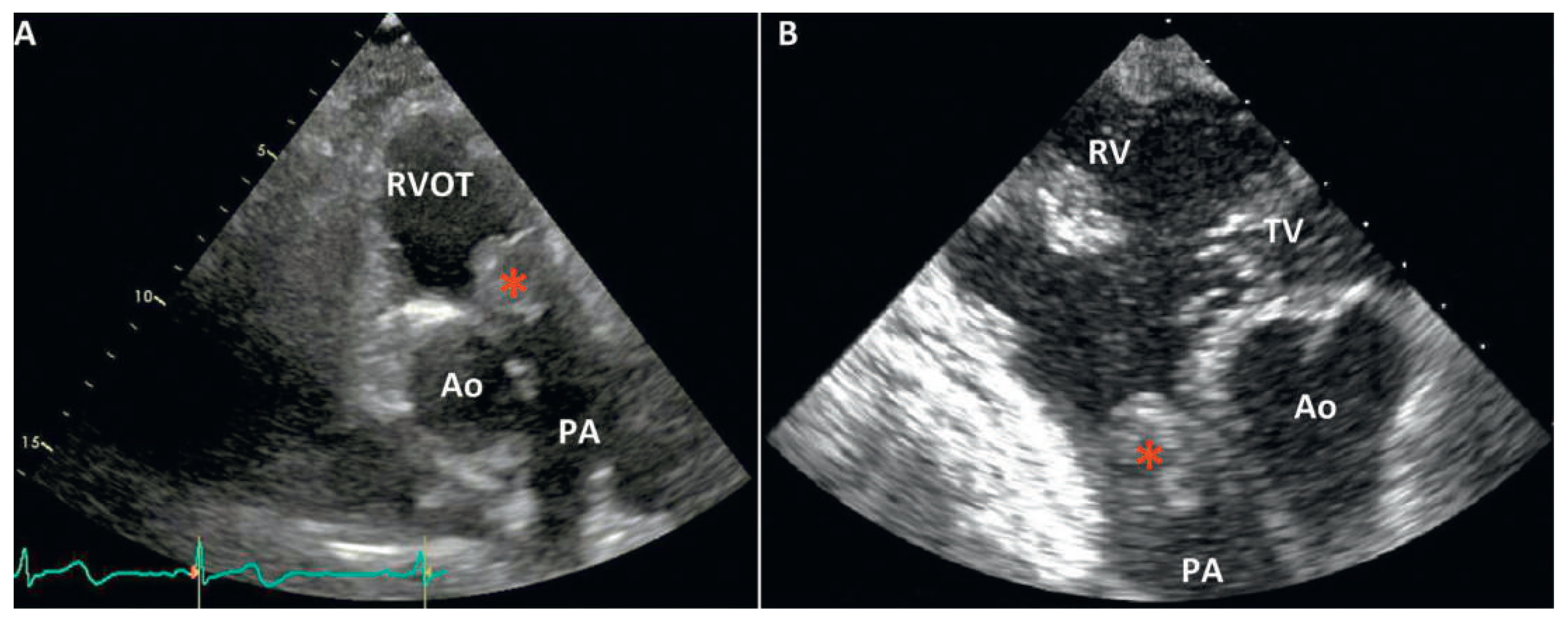 Cardiovascmed 18 00186 g001