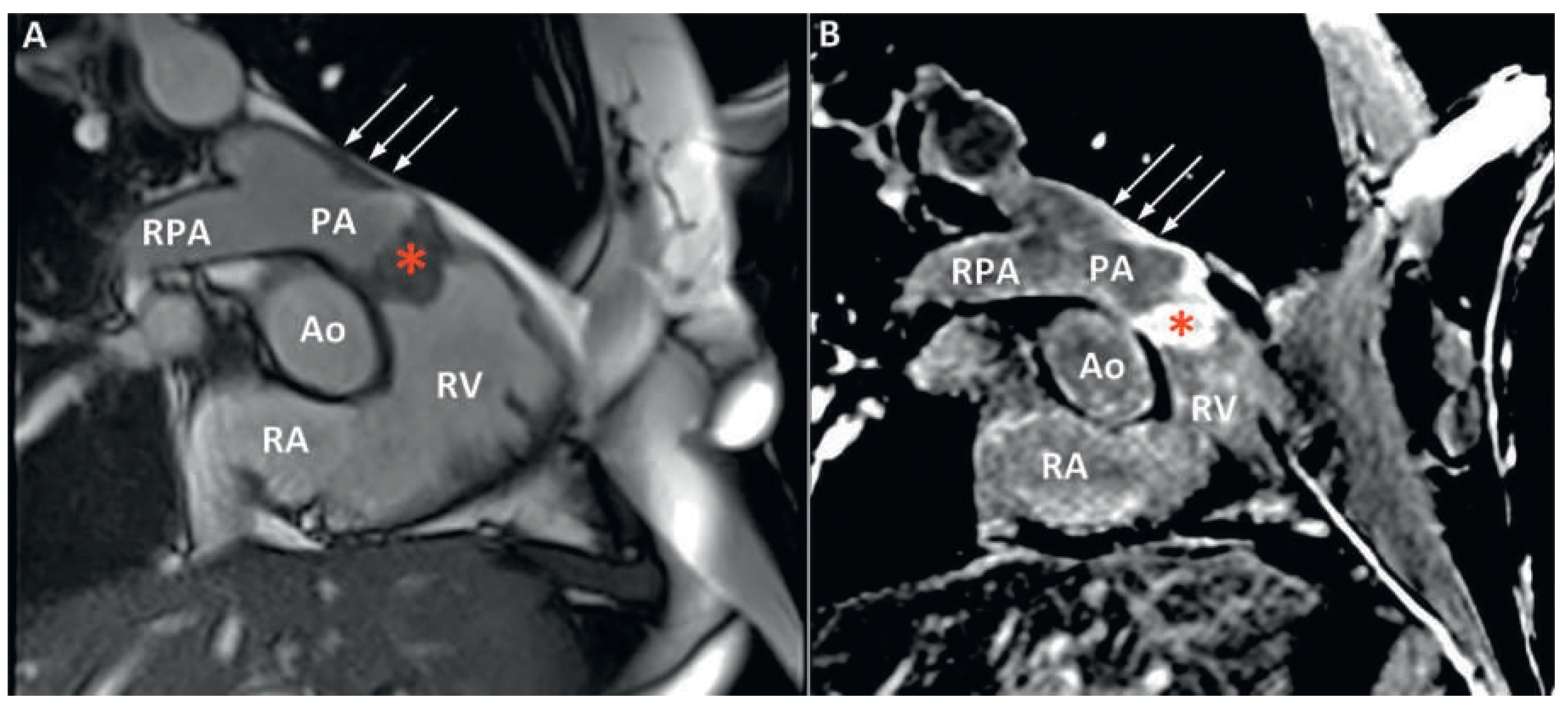 Cardiovascmed 18 00186 g004